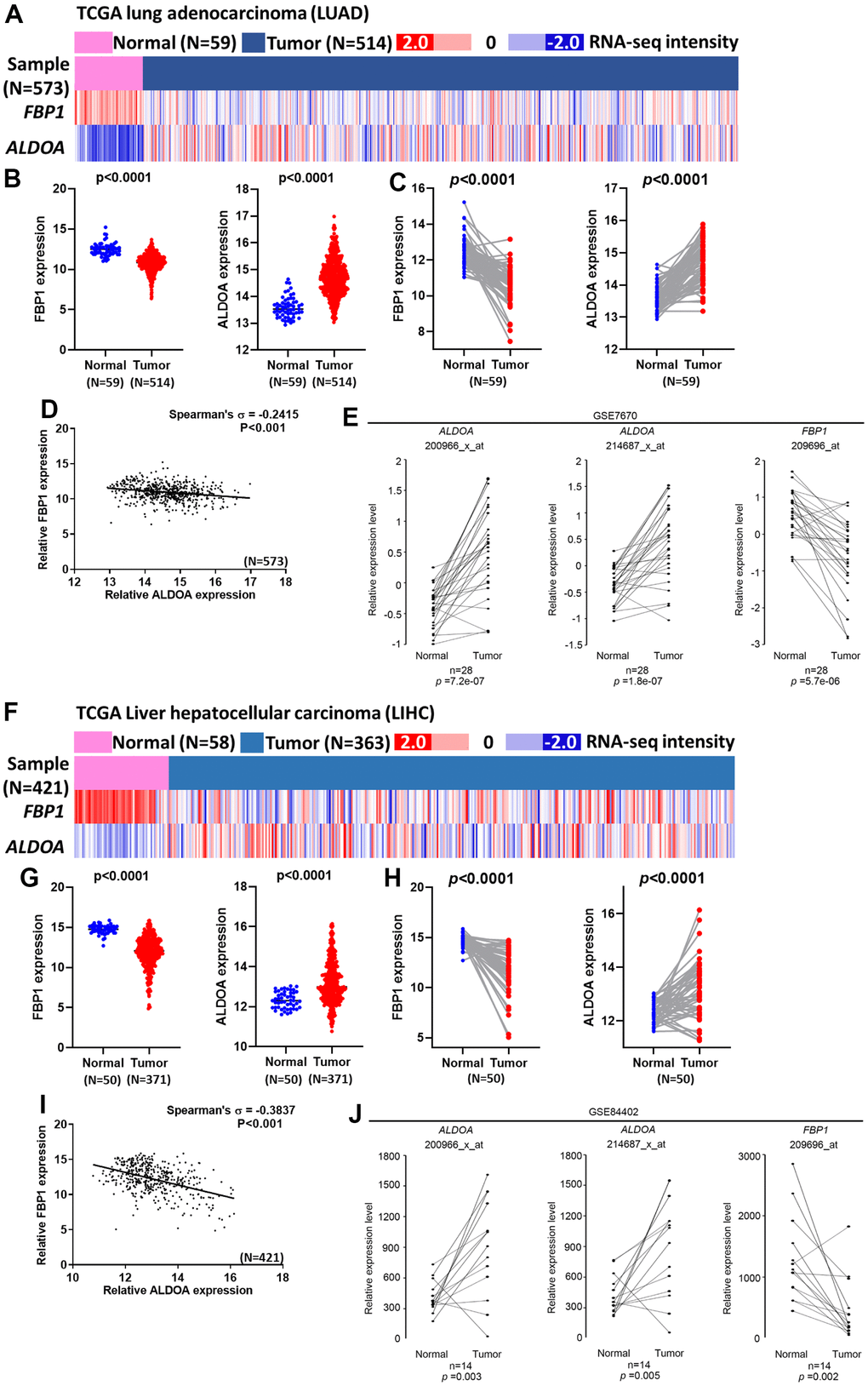 A negative correlation between ALDOA and FBP1 exists in LUAD and LIHC patients. (A) The heatmap shows the expression of ALDOA and FBP1 in TCGA lung adenocarcinoma (LUAD) patients. (B) The related expression of ALDOA and FBP1 in the normal and LUAD tumor groups in TCGA lung adenocarcinoma (LUAD). (C) A paired analysis reveals the difference between ALDOA and FBP1 in TCGA lung adenocarcinoma (LUAD). (D) The correlation between ALDOA and FBP1 in TCGA lung adenocarcinoma (LUAD). (E) A paired analysis revealed the difference between ALDOA and FBP1 in GSE7670. (F) The heatmap shows the related expression of ALDOA and FBP1 in TCGA Liver Cancer (LIHC) patients. (G) The related expression of ALDOA and FBP1 in normal and LIHC tumor groups in TCGA Liver Cancer (LIHC). (H) A paired analysis revealed the difference between ALDOA and FBP1 in TCGA Liver Cancer (LIHC). (I) The correlation between ALDOA and FBP1 in TCGA Liver Cancer (LIHC). (J) A paired analysis revealed the difference between ALDOA and FBP1 in GSE84402. The significance of the differences in (B, C, E, G, H, J) was analyzed using unpaired Student’s t-tests. The significance of the differences in (D, I) was analyzed using Spearman's rank correlation coefficient. N or n is denoted as sample size.