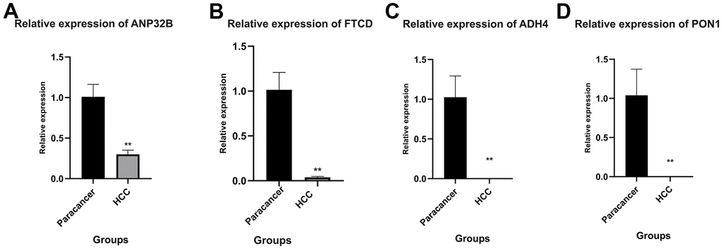 Quantitative real-time polymerase chain reaction (qRT-PCR). (A–D) ANP32B, FTCD, ADH4 and PON1 were differentially expressed in HCC cells and normal para-cancer tissues. The expression levels of these four genes were all downregulated in HCC, and the expression levels of ADH4 and PON1 were very low. (**P