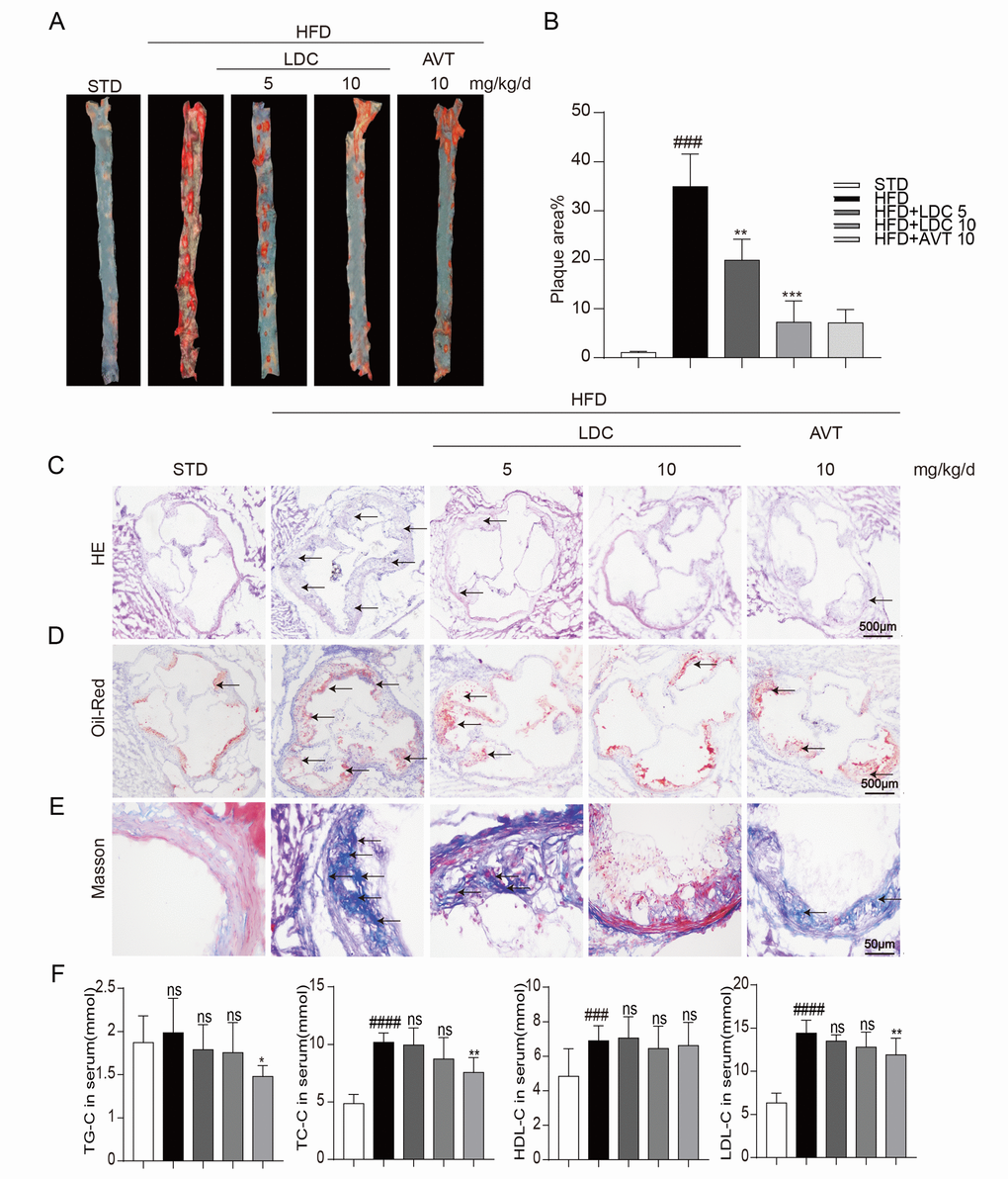 CDK9 inhibitor reduces indices of atherosclerotic lesions in ApoE-/- mice fed with HFD. (A–B) Representative en face Oil Red O staining and quantification of Oil Red O-positive lipid area in the aorta (n = 8; ###p p C) Photomicrographs showing representative H&E staining of atherosclerotic lesions (scale bar = 500 μm). (D) Oil Red O staining of atherosclerotic lesions in the aortic root (scale bar = 500 μm) and quantification lesions area highlighted by Oil Red O staining. (E) Representative images of Masson’s Trichome staining for collagen deposition (scale bar = 50 μm). (F) Serum levels of TG, TC, LDL and HDL (n = 8; #P ##P ###p P P 