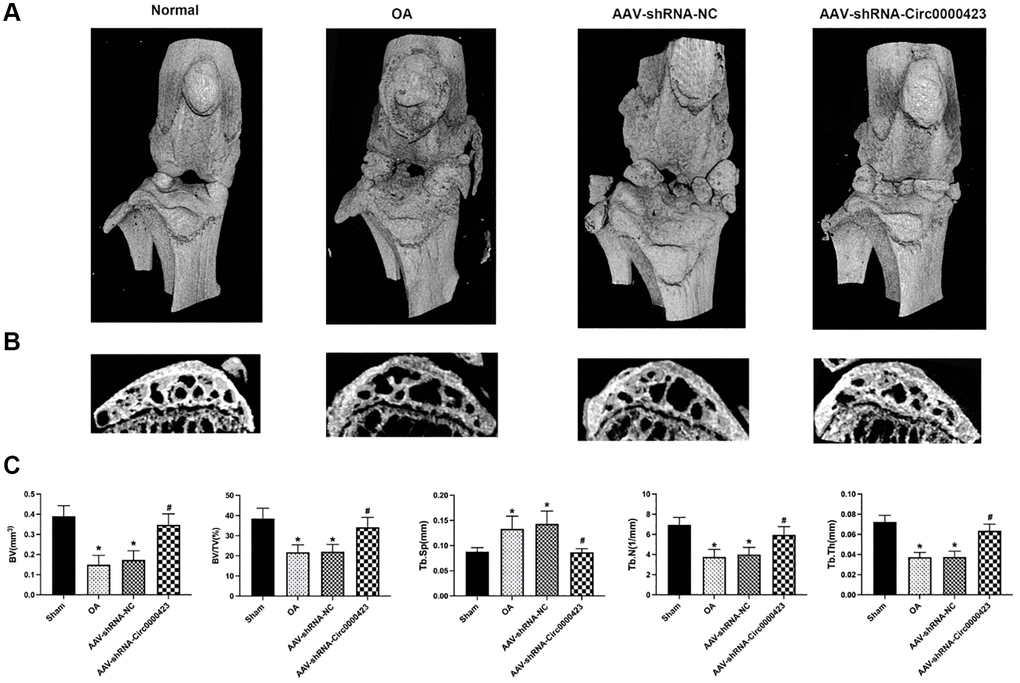 Silencing of Circ