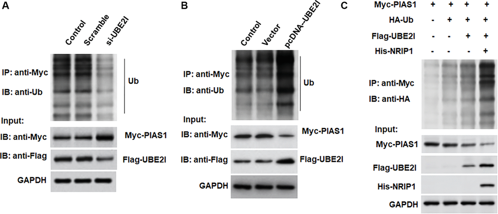 UBE2I accelerates PIAS1 ubiquitination for degradation. (A) The si-UBE2I was transfected into cells and the ubiquitination level of PIAS1 was detected by co-immunoprecipitation assay. (B) The pcDNA-UBE2I was transfected into cells and the ubiquitination level of PIAS1 was detected by co-immunoprecipitation assay. (C) UBE2I was overexpressed alone or simultaneously with NRIP1, and the ubiquitination level of PIAS1 was detected by co-immunoprecipitation assay. GAPDH was used as an internal reference. N = 6, *P 