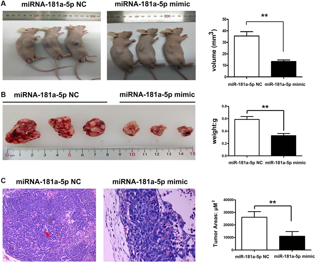 Upregulation of miR-181a-5p inhibited tumor growth and metastasis of ESCC. Nude mice were injected subcutaneously with ESCC cells and intratumorally injected with miR-181a-5p via. (A) The tumor volume in miR-181a-5p mimics and negative control mice; (B) the tumor weight in miR-181a-5p mimics and negative control mice; *P C) H&E staining in experimental mice; *P **P 