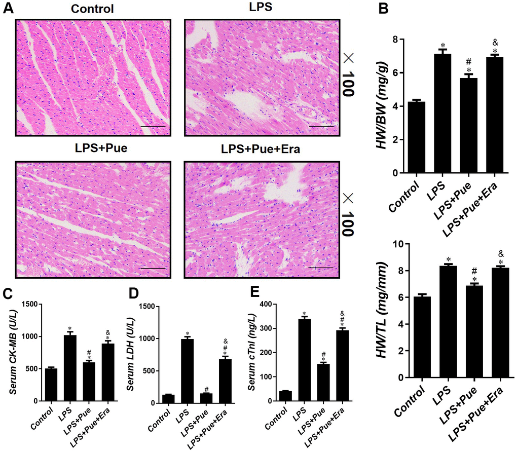 Puerarin attenuates LPS-induced myocardial injuries in mice. (A) He staining sections were used to observe the pathological changes of heart tissues. The ratio of HW/BW (B) and HW/TL (B) is used to reflect the degree of cardiac edema. The concentrations of (C) CK-MB, (D) LDH and (E) cTnI in serum of mice were determined by ELISA. Data represent the mean ± SD. *P 