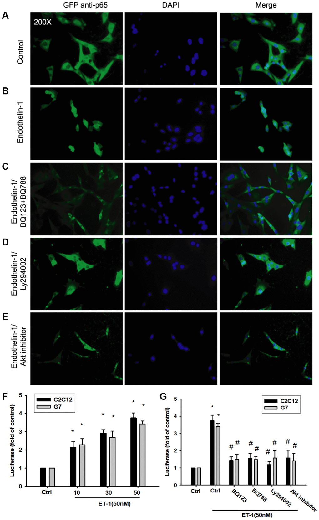 The PI3K/Akt signaling pathway is involved in endothelin-1 or ET-1–mediated NFκB activity IL-6 and TNF-α expression. (A–E) C2C12 and G7 cells were pretreated with BQ123, BQ788, Ly294002, or Akt inhibitor followed, by stimulation with ET-1, and were analyzed using immunofluorescence assay. (F) C2C12 and G7cells were incubated for 24 h with various concentrations of ET-1, and in vitro NFκB-luciferase activity was measured. (G) C2C12 and G7cells were pretreated with BQ123, BQ788, Ly294002, or Akt inhibitor for 30 min stimulated for 24 h with ET-1 (50 nM), and in vitro NFκB–luciferase activity was measured. Results are expressed of four independent experiments performed in triplicate. *p #p 