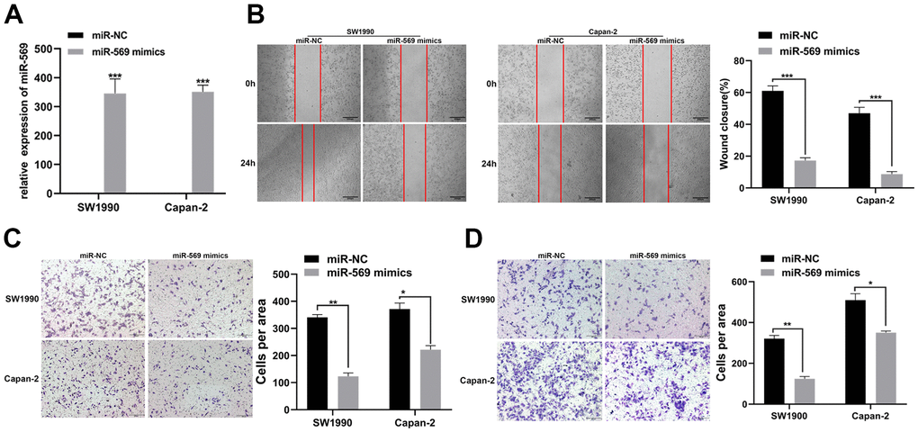 miR-569 inhibited the migration and invasion of PC cells in vitro. (A) RT-qPCR showed the miR-569 transfection efficiency. (B) Wound healing assay demonstrated migratory abilities of PC cells after over-expression of miR-569; (C) Transwell assay showed migratory abilities of PC cells after over-expression of miR-569; (D) Transwell assay indicated invasive abilities of PC cells after over-expression of miR-569. (* p  0.05, ** p  0.01, *** p  0.001, n = 3, Student’s t-test, means ± 95% CI).