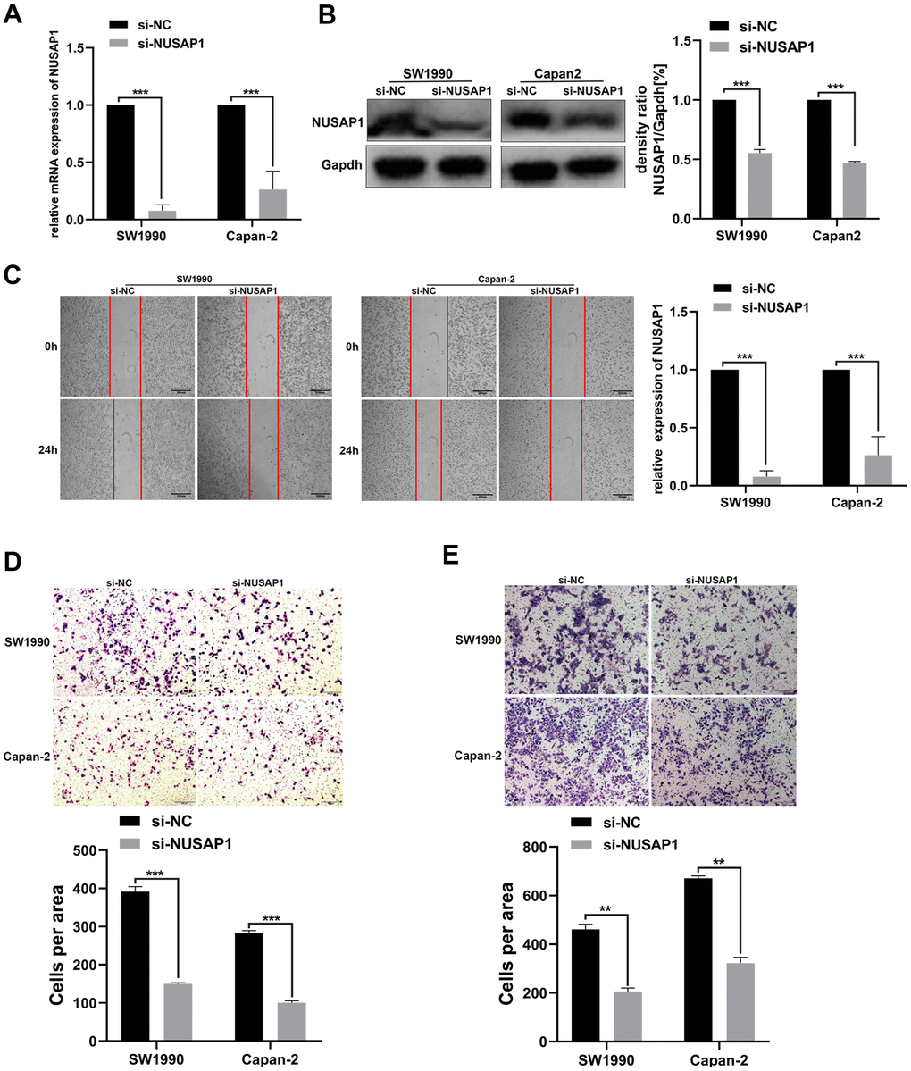 NUSAP1 promoted the migration and invasion of PC cells. (A) Western blot and (B) qRT-PCR were performed to verify transfection efficiency (*p  0.05). (C) Wound healing assay showed migratory abilities of PC cells after knocking down NUSAP1; (D) Transwell assay indicated migratory abilities of PC cells after knocking down NUSAP1; (E) Transwell assay showed invasive abilities of PC cells after knocking down NUSAP1. GAPDH was used as a loading control in Western blot assay. (* p  0.05, ** p  0.01, *** p  0.001, n = 3, Student’s t-test, means ± 95% CI).