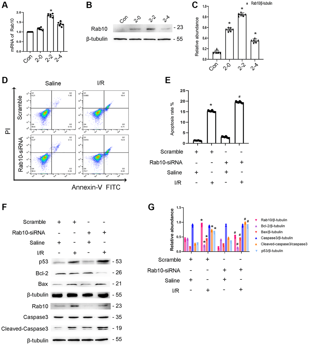 Knockdown Rab10 aggravates I/R-induced BUMPT cells apoptosis and the expression of cleaved-caspase3. BUMPT cells were transfected with siRNA Rab10 (100 nM), and then treated with I(2 hours)/R(2 hours) injury. (A) RT-qPCR analysis of the expression of Rab10. (B) Immunoblot analysis of Rab10 and β-tubulin at indicated time points. (C) Densitometric analysis of proteins signals. (D) FCM analysis of BUMPT cells apoptosis. (E) The apoptosis rate (%). (F) Immunoblot analysis of caspase 3, cleaved-caspase3, Bax, Blc-2, p53 and Rab10. (G) Densitometric analysis of proteins signals. Data are expressed as mean ± SD (n = 6). *p #p 