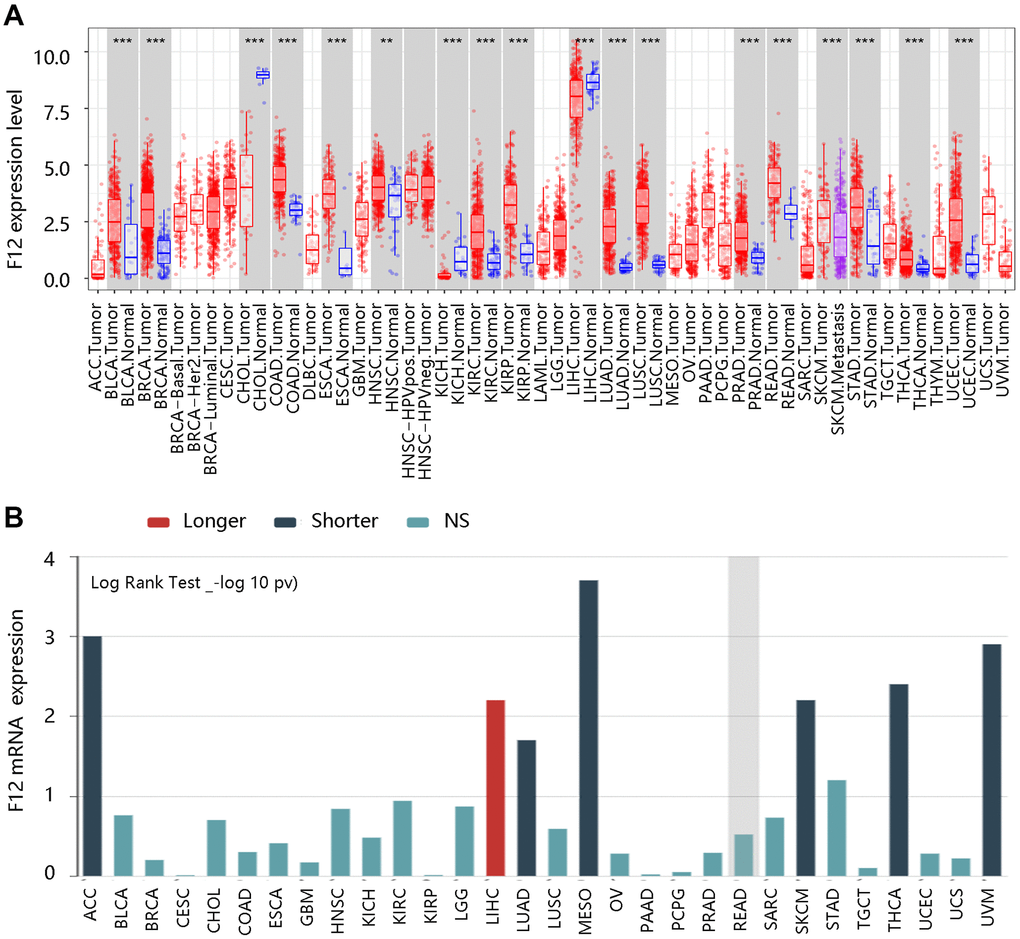The clinical value of F12 in pan-cancer. (A) The expression analysis of F12 in various cancers via TIMER. **P B) The survival analysis F12 across human cancers via TISIDB.
