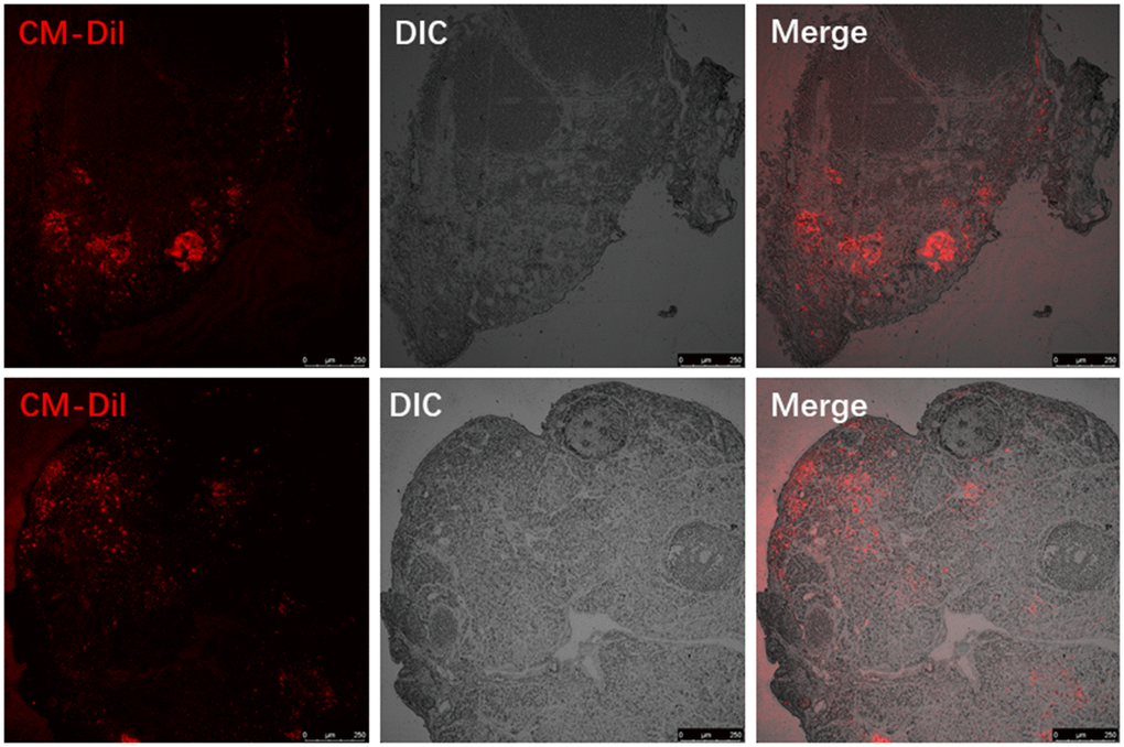 Visualizing the red fluorescent CM-Dil labelled MenSCs in the ovaries of two individual recipient mice.