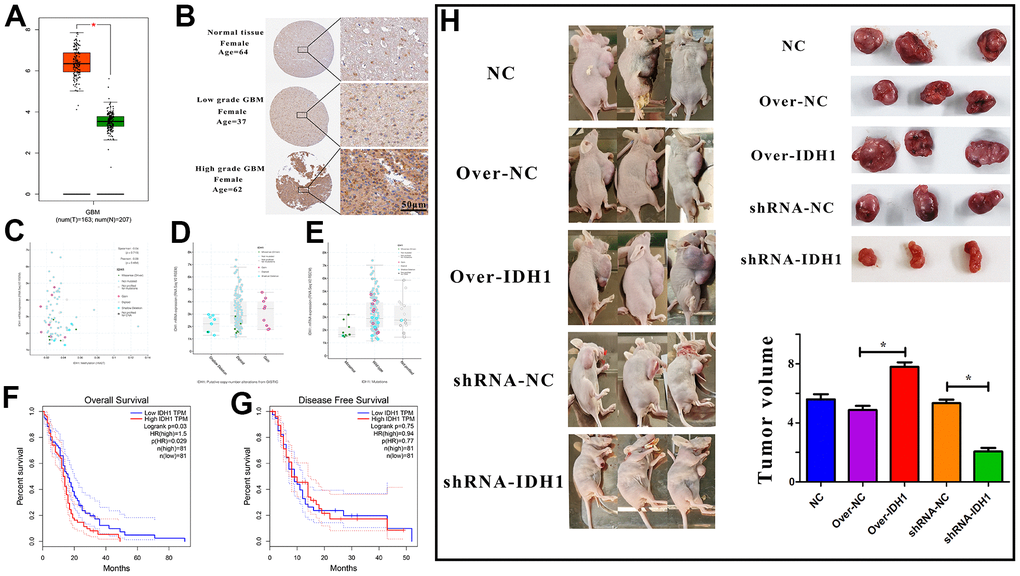 The expression of IDH1 in GBM. (A) The box figure shows the expression of IDH1 in tumor (n=163) and normal tissues (n=207) with error bars. The red box represents tumor samples and the green one represents normal samples. *, p-value≤0.05. (B) The protein level of IDH1 in different GBM grades. The pictures of immunohistochemistry results with different magnifications. (C–E) The scatter and box diagram shows the correlation between IDH1 mRNA level and methylation, copy number and mutation, respectively. The legend and coefficient of association were listed on the right. (F, G) The survivorship curves of OV and DFS with a confidence interval, respectively. The red curve represents samples with a higher level of IDH1. Oppositely, the blue one represents samples with a lower level of IDH1. The related parameters were listed on the right. (H) Representative images of subcutaneous tumors originated from transfected GBM cells and the corresponding statistical results.