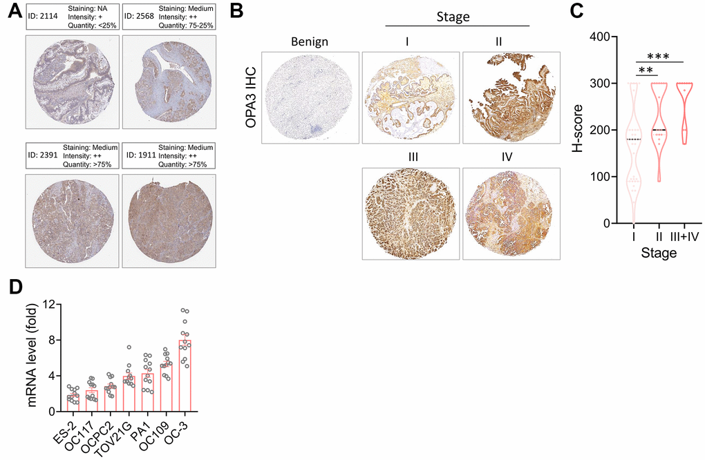 Protein levels of OPA3 in ovarian carcinoma. (A) Representative images of OPA3 IHC staining in ovarian cancer from the human Protein Atlas dataset. (B) Representative images of OPA3 expression at different stages of OV. (C) Violin plots of OPA3 expression levels OV in different stages. (D) RT-PCR was used to detect the expression levels of different ovarian cancer cells. ** p 