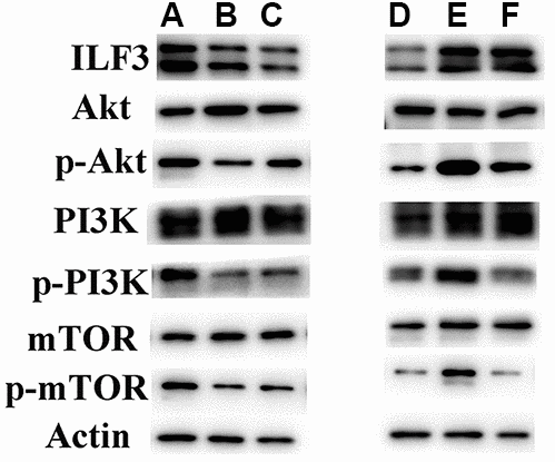 ILF3 was involved in the regulation of PI3K/AKT/mTOR signaling pathway in gastric cancer cell SGC-7901. (A:ox-LDL+si-nc;B:ox-LDL+si-ILF3;C:ox-LDL+statin;D:ox-LDL+CMV-2;E:ox-LDL+flag-ILF3;F:ox-LDL+flag-ILF3+PI3K/AKT inhibitor LY294002). (A–C) ILF3-specific small interference RNA (si-ILF3) and statins treatment significantly inhibited PI3K/AKT/mTOR signaling pathway. The expression of p-PI3K/PI3K, p-AKT/AKT, and p-mTOR/mTOR were significantly downregulated compared to control group. And the expression of PI3K, Akt and mTOR and p-mTOR did not change significantly. (D–F) ILF3-overexpressed plasmids (flag-ILF3) treatment significantly activated PI3K/AKT/mTOR signaling pathway. The expression of p-PI3K/PI3K, p-AKT/AKT, and p-mTOR/mTOR were significantly upregulated compared to vector plasmids (CMV2) group. PI3K/AKT inhibitor LY294002 treatment significantly inhibited the PI3K/AKT/mTOR signaling pathway.