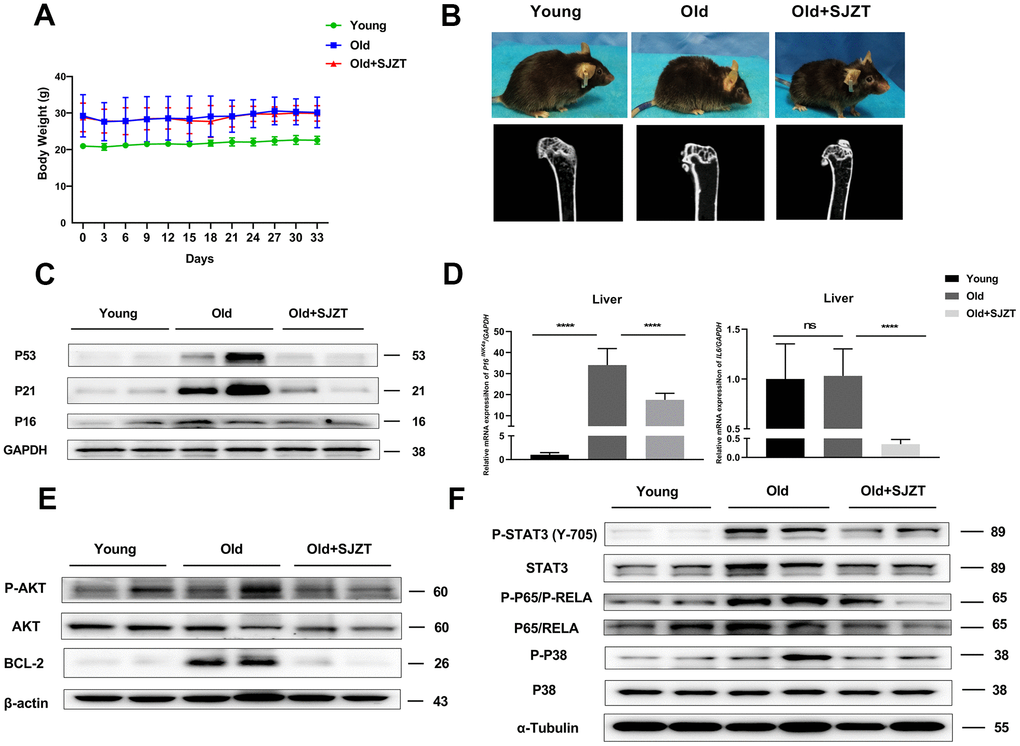 SJZT can improve the aging-related phenotype of aging mice. (A) Body weight of mice after SJZT or distilled water treatment. (B) Representative photos of the old mice and after SJZT treatment with considerable differences in skin and in hair. And μCT of the isolated shin bones to assess bone porosity. (C) The protein levels of P16, P21 and P53 determined by Western blots in mice liver tissue. (D) The mRNA levels of p16 and IL6 determined by qPCR in mice Liver tissue. (E, F) The protein expression levels of liver tissues were detected by western blot analysis. Data represent the means ± standard deviation. *P0.05, **P***P