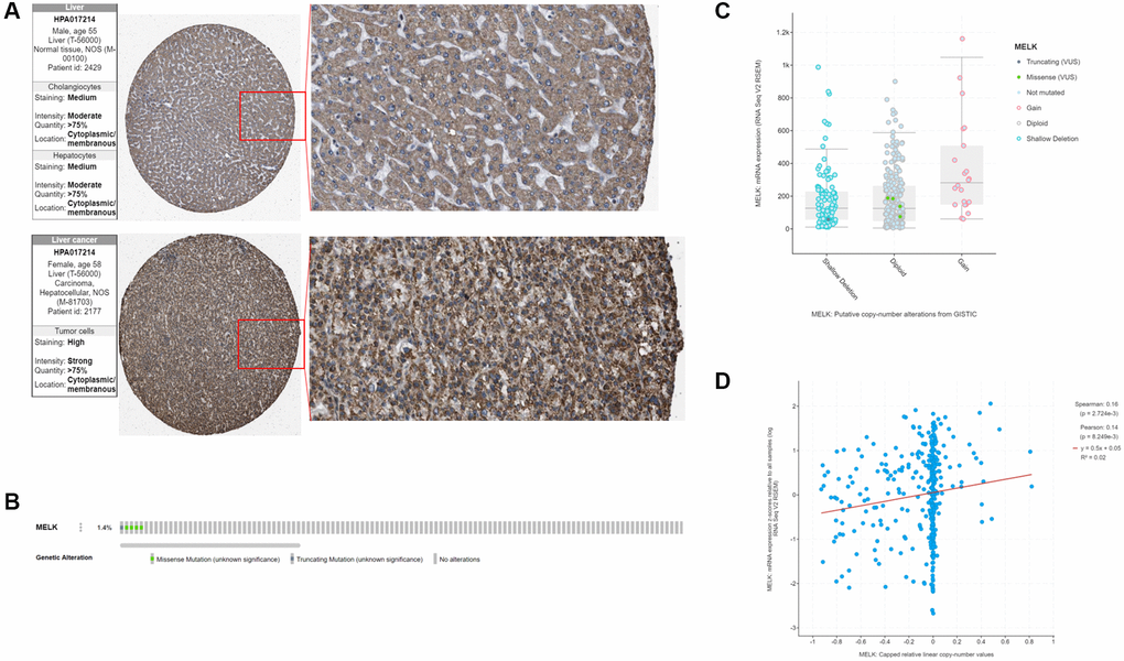 MELK in HCC (A) Verification of MELK protein levels using immunohistochemical data from the Human Protein Atlas database. (B) MELK genomic alterations in TCGA HCC shown on a cBioPortal OncoPrint plot. Association between MELK copy number and mRNA level shown by dot plot (C) and correlation plot (D) using cBioPortal.