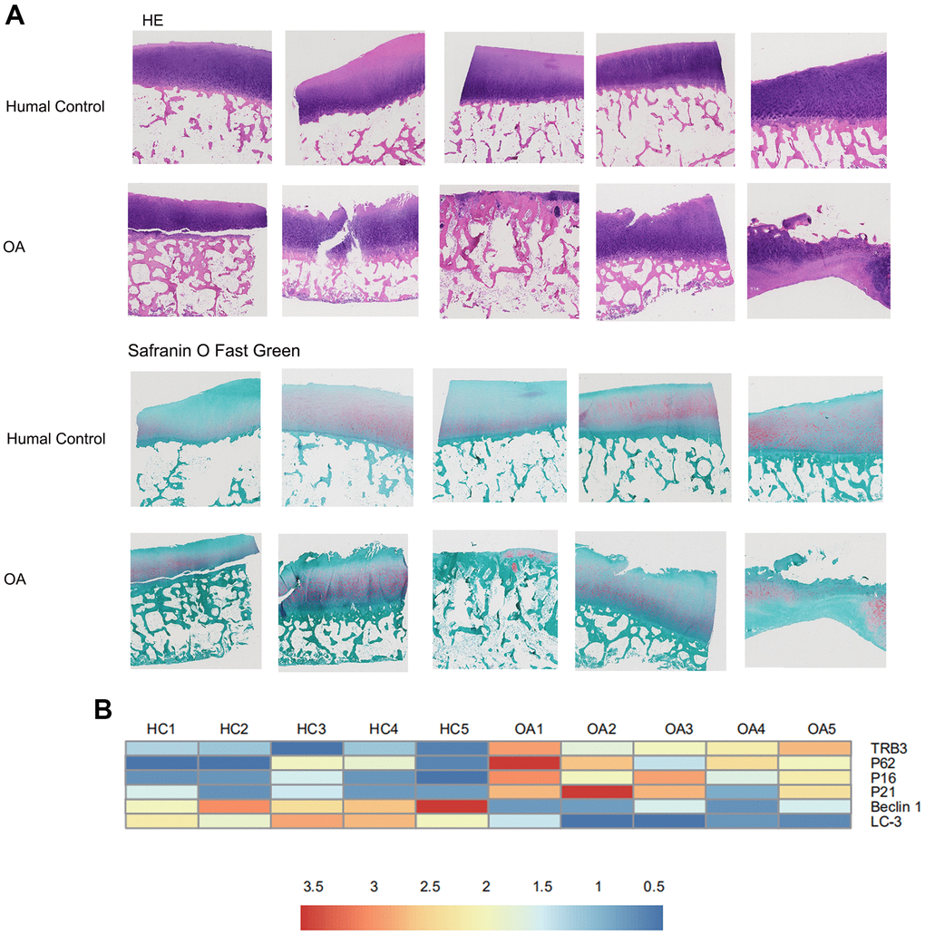 The results of histology for cartilage degradation in the control and osteoarthritis groups. (A) Representative photomicrographs HE staining and Safranin-O/Light Green Red staining of joint pathological sections of normal joints and OA model, (B) Heatmap analyses of the key molecules regulated in OA patients and healthy controls based on transcriptome analysis. Green, low expression levels; red, high expression levels.