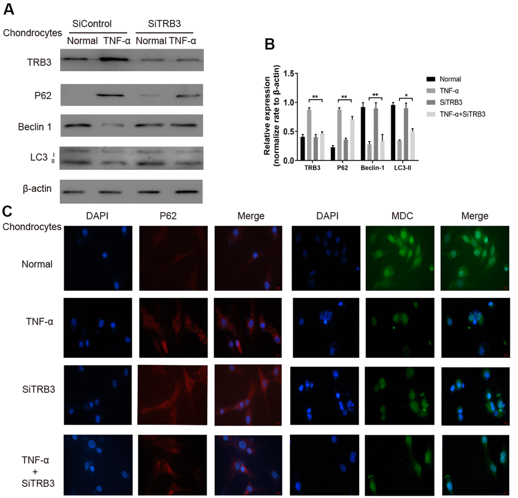 Chondrocyte autophagy is dependent on TRB3. (A, B) Protein expression of TRB3, P62, Beclin 1 and LC3 in isolated chondrocytes from young healthy treated with TNF-α, TRB3 siRNA or control siRNA. (C) Chondrocyte autophagic activity was detected by Immunofluorescence of P62 and MDC staining. The results are described as the mean ± SD. *P 