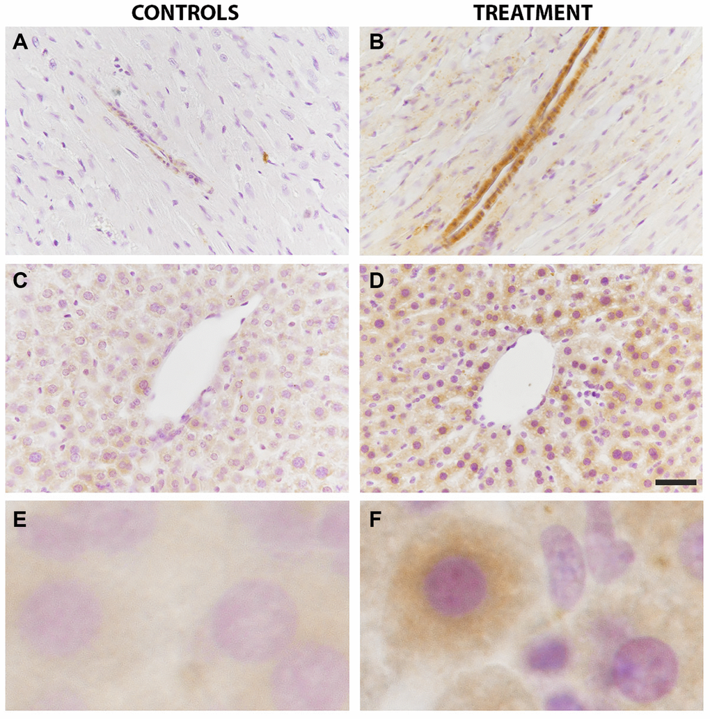 LC3B immunoreactivity in the liver and heart was increased by chloroquine treatment. In the heart tissue, a strong immunostaining was visible in the smooth muscle layer of both arterioles and venules from the parenchyma of treated animals as compared to controls (A vs B). In the liver, LC3B immunostaining showed a diffuse granular pattern in the cytoplasm of hepatocytes that was more intense in treated animals as compared to controls (C vs D). Enlarged images are shown for controls (E) and treatment (F). N = 10 for each group.