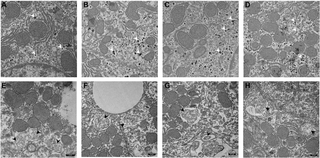 Electron microscopy images of autophagosomes in mouse liver. Control animal (A–D) vs. Chloroquine-treated animal (E–H). Highlighted are glycogen granules (white arrow) in controls and autophagosomes (black arrow) in the liver of treated animals. Scale bar, 0,5 μm. N = 3 for each group.