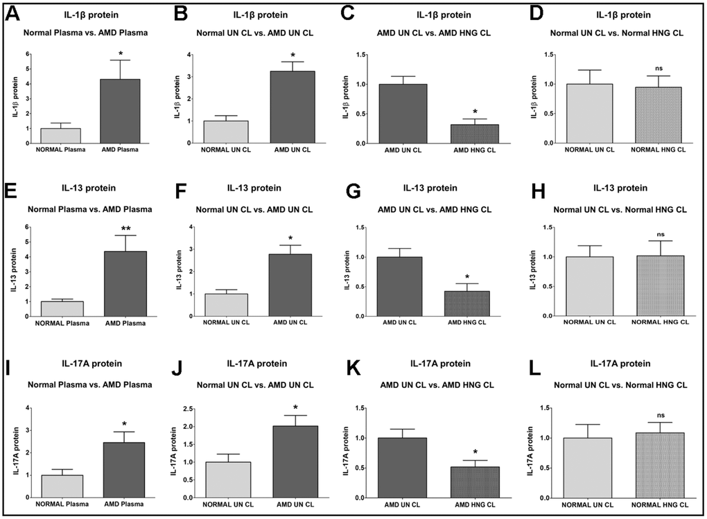 Effect of Humanin G (HNG) on IL-1β, IL-13, and IL-17A proteins. IL-1β protein was elevated in AMD plasma (A) and in AMD RPE cybrid cells (B) compared to their normal counterparts. Treatment with HNG reduced IL-1β protein levels in AMD RPE cybrid ells (C) but not in normal RPE cybrid cells (D), compared to their untreated counterparts. IL-13 protein was elevated in AMD plasma (E) and in AMD RPE cybrid cells (F) compared to their normal counterparts. Treatment with HNG reduced IL-13 protein levels in AMD RPE cybrid ells (G) but not in normal RPE cybrid cells (H), compared to their untreated counterparts. IL-17A protein was elevated in AMD plasma (I) and in AMD RPE cybrid cells (J) compared to their normal counterparts. Treatment with HNG reduced IL-17A protein levels in AMD RPE cybrid ells (K) but not in normal RPE cybrid cells (L), compared to their untreated counterparts. Data are presented as mean ± SEM. * P