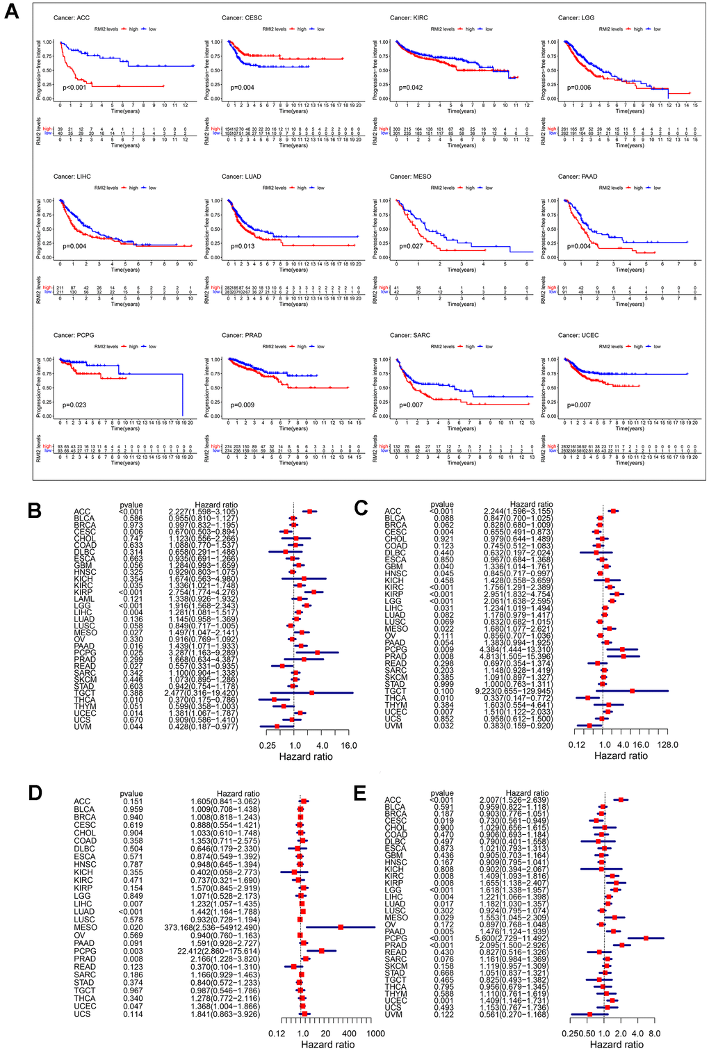 Correlation between RMI2 expression in patients with DFI (A). (A) Survival analyses of RMI2 expression via the Kaplan–Meier PFI curves in ACC, CESC, KIRC, LGG, LIHC, LUAD, MESO, PAAD, PCPG, PRAD, SARC and UCEC. Cox proportional risk model was used to study the effect of RMI2 on the prognosis of multiple human tumors (B–E). (B) Effect of RMI2 on OS in 33 human tumors. (C) Effect of RMI2 on DSS in 33 human tumors. (D) Effect of RMI2 on DFS in 33 human tumors. (E) Effect of RMI2 on PFI in 33 human tumors.