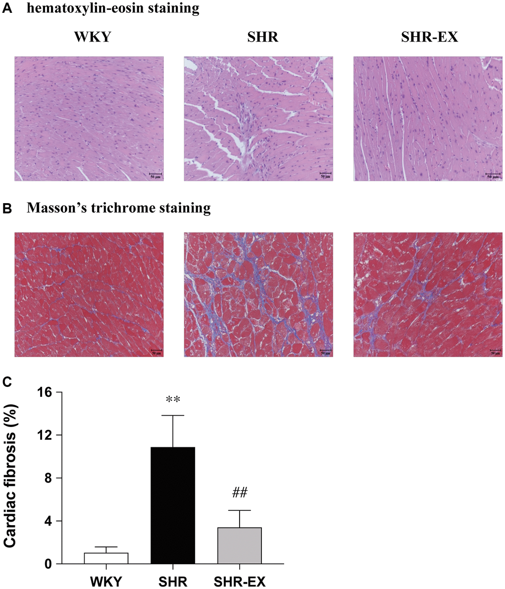 Representative histopathological analysis of cardiac tissue sections was performed with (A) hematoxylin-eosin staining (interstitial space: wide, arrows indicated) and (B) Masson’s trichrome staining (fibrosis: blue color, arrows indicated). The images of the myocardial architecture are magnified 200×; Bar scales = 50 μm. (C) The bar represents the percentage of blue area to the field area in Masson’s trichrome staining. Data are expressed as the mean values ± SD (n = 6 in each group). **P ##P 