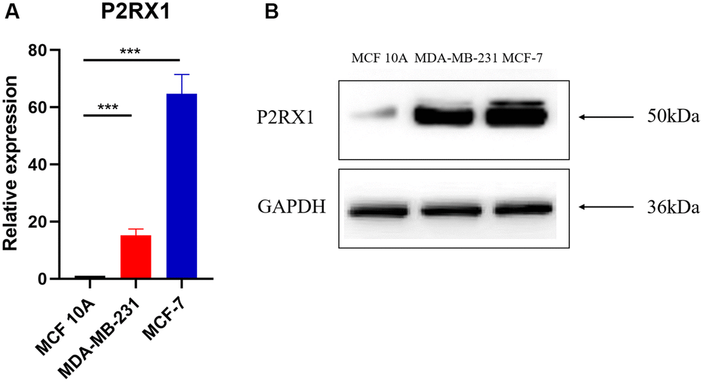 P2RX1 expression in normal human mammary epithelial cell line and two human breast cancer cell lines. (A) Analysis of P2RX1 expression by RT-qPCR. (B) Analysis of P2RX1 expression by Western blot.