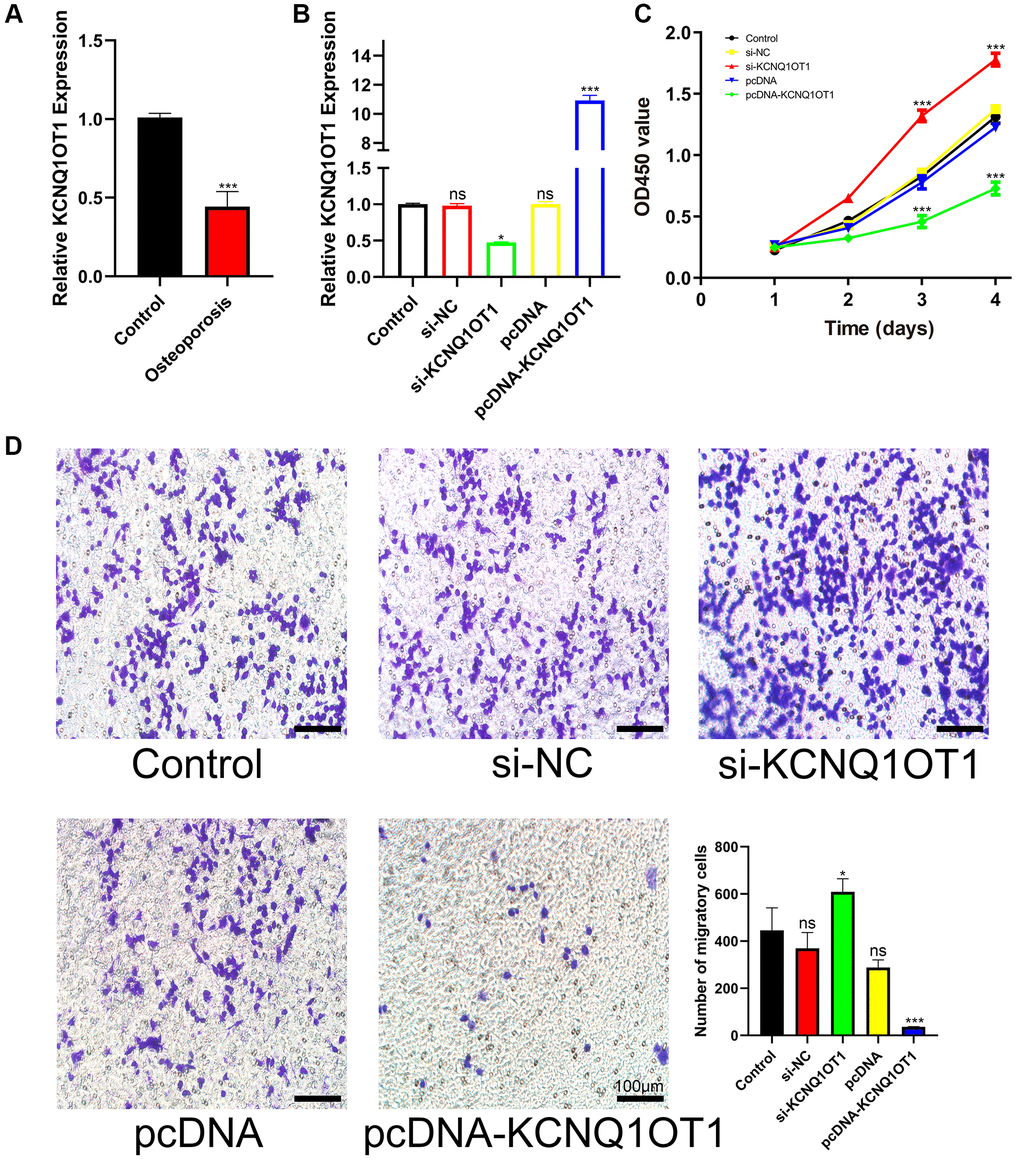 KCNQ1OT1 suppresses the proliferation and migration of RAW 264.7 cells. (A) qRT-PCR for relative expression of KCNQ1OT1 in six bone tissues (three osteoporotic and three non-osteoporotic). (B) Relative expression of KCNQ1OT1 in RAW 264.7 cells transfected with pcDNA-KCNQ1OT1, si-KCNQ1OT1 or control vectors, as measured by qRT-PCR. (C) The proliferation curve and (D) transwell migration assays of RAW 264.7 cells transfected with pcDNA-KCNQ1OT1, si-KCNQ1OT1 or corresponding control vectors (Scale bar: 100 μm). *P ***P 