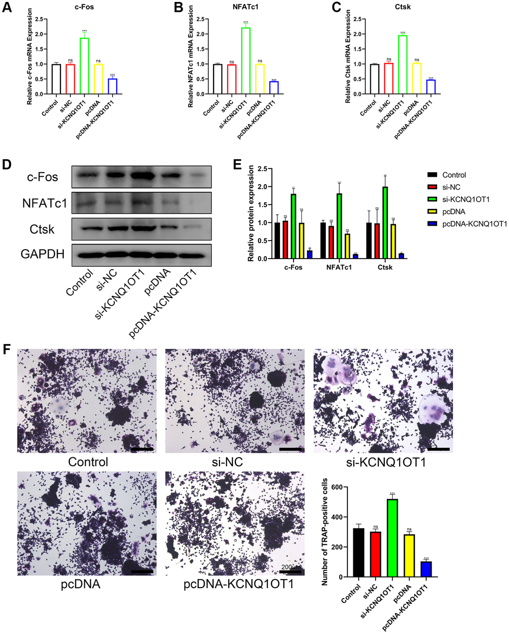 KCNQ1OT1 inhibits the osteoclast differentiation of RAW 264.7 cells. (A–E) RAW 264.7 cells transfected with pcDNA-KCNQ1OT1, si-KCNQ1OT1, or corresponding control vectors and treated with RANKL for 5 days, the mRNA and protein levels of the osteoclastogenesis markers c-Fos, NFATc1, and Ctsk were measured by qRT-PCR and Western blotting. (F) A Tartrate-resistant acid phosphatase (TRAP) staining kit was used for osteoclast staining, and TRAP-positive multinucleated cells were counted (Scale bar: 200 μm). *P **P ***P 