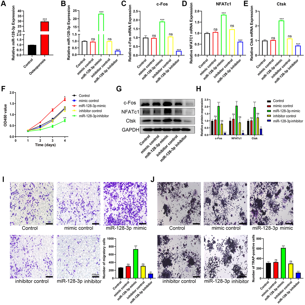 miR-128-3p promotes the viability and osteoclast differentiation of RAW 264.7 cells. (A) qRT-PCR for relative expression of miR-128-3p in bone tissues (three non-osteoporotic and three osteoporotic). (B) RAW 264.7 cells were transfected with miR-128-3p mimic or miR-128-3p inhibitor, respectively. The expression levels of miR-128-3p were measured by qRT-PCR. (C–E) The mRNA levels of c-Fos, NFATc1, and Ctsk were analyzed by qRT-PCR, respectively. (F) The influence on cell proliferation ability of miR-128-3p mimic and miR-128-3p inhibitor was assessed by CCK-8 assay. (G and H) The protein levels of c-Fos, NFATc1, and Ctsk were analyzed by Western blotting, respectively. (I) Transwell assay detecting the migration ability of RAW 264.7 cells (Scale bar: 100 μm). (J) Representative images of TRAP-positive osteoclasts formation (Scale bar: 200 μm). *P **P ***P 