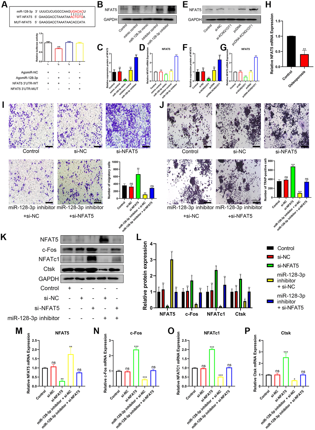 miR-128-3p regulates the migration and osteoclast differentiation of RAW 264.7 cells by targeting NFAT5. (A) StarBase database showing the putative binding sites between miR-128-3p and NFAT5. The relative luciferase activity was detected in HEK-293T cells transfected with agomiR-NC or agomiR-128-3p in WT and MUT groups, respectively. (B–D) The mRNA and protein expression of NFAT5 after transfection of miR-128-3p mimic or miR-128-3p inhibitor, were analyzed by qRT-PCR and Western blotting, respectively. (E–G) The mRNA and protein expression of NFAT5 after transfection of pcDNA-KCNQ1OT1 or si-KCNQ1OT1, were analyzed by qRT-PCR and Western blotting, respectively. (H) Relative expression of NFAT5 in non-osteoporotic and osteoporotic bone tissues was detected by qRT-PCR (N = 6, 3 osteoporotic and 3 non-osteoporotic). (I) The influence on cell migration ability of si-NFAT5 and the rescue effect of miR-128-3p inhibitor was assessed by transwell migration assay (Scale bar: 100 μm). (J) Multinucleated osteoclasts were stained by TRAP and then counted (Scale bar: 200 μm). (K–P) Five days after osteoclastic differentiation, qRT-PCR and Western blotting were performed to detect the mRNA and protein levels of NFAT5, c-Fos, NFATc1, and Ctsk in RAW 264.7 cells transfected with si-NFAT5, miR-128-3p inhibitor or si-NFAT5 + miR-128-3p inhibitor. *P **P ***P 