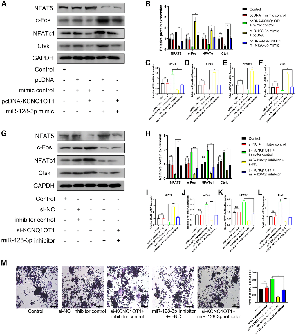 KCNQ1OT1 inhibits osteoclast differentiation by upregulating NFAT5 expression via sponging miR-128-3p. (A–F) RAW 264.7 cells were transfected with pcDNA-KCNQ1OT1, miR-128-3p mimic or pcDNA-KCNQ1OT1 + miR-128-3p mimic respectively, and then treated with RANKL for 5 days. qRT-PCR and Western blotting showed the mRNA and protein expression levels of NFAT5, c-Fos, NFATc1, and Ctsk. (G–L) Similar experiments were also performed in RAW 264.7 cells transfected with si-KCNQ1OT1, miR-128-3p inhibitor or si-KCNQ1OT1 + miR-128-3p inhibitor. (M) Multinucleated osteoclasts were stained by TRAP and then counted (Scale bar: 200 μm). *P **P ***P 