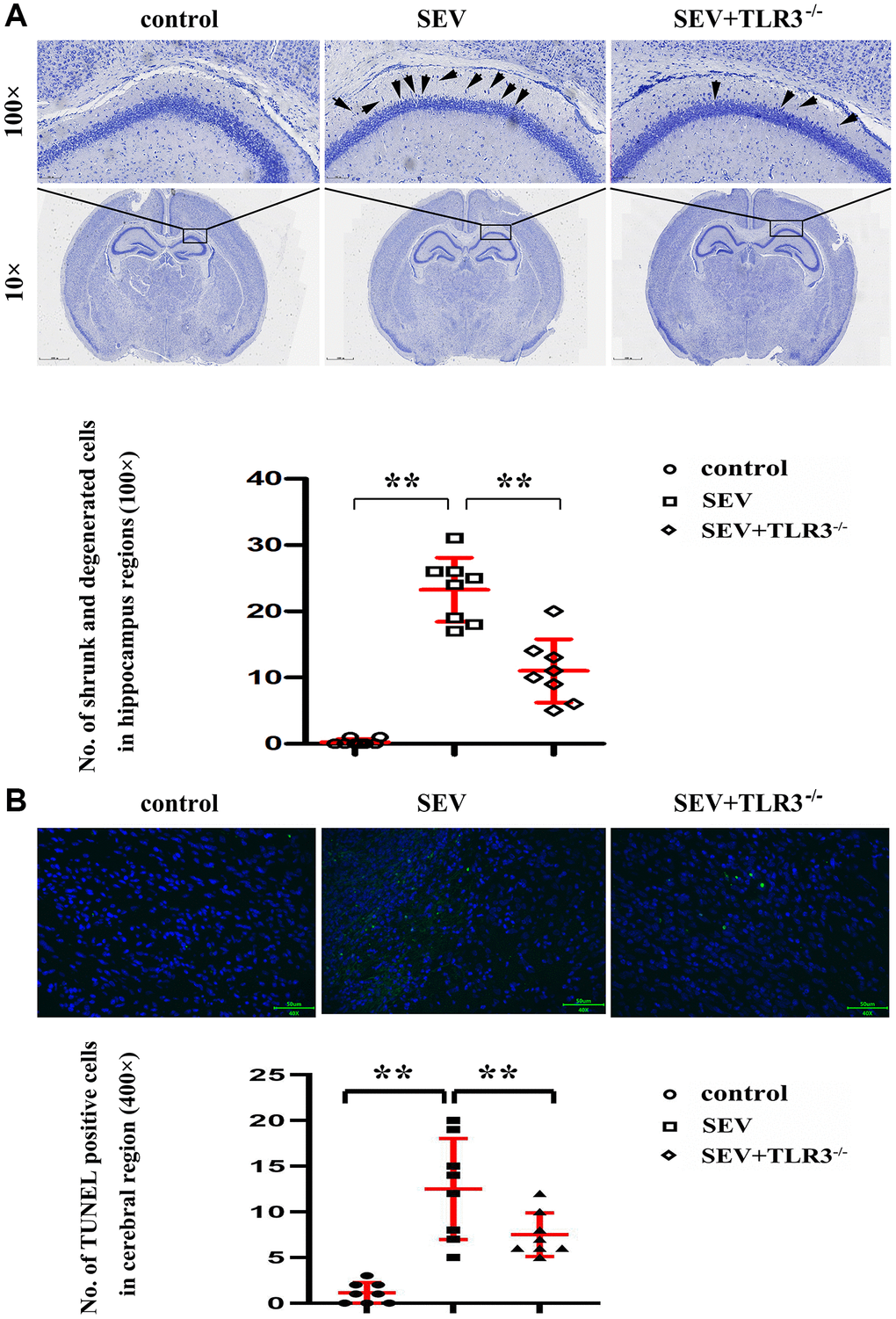 (A) Results of Nissl staining in the cortical and hippocampal regions of neonatal mice (Magnification is 100× and 400×, respectively), (B) TUNEL staining in the brain tissues of neonatal mice.