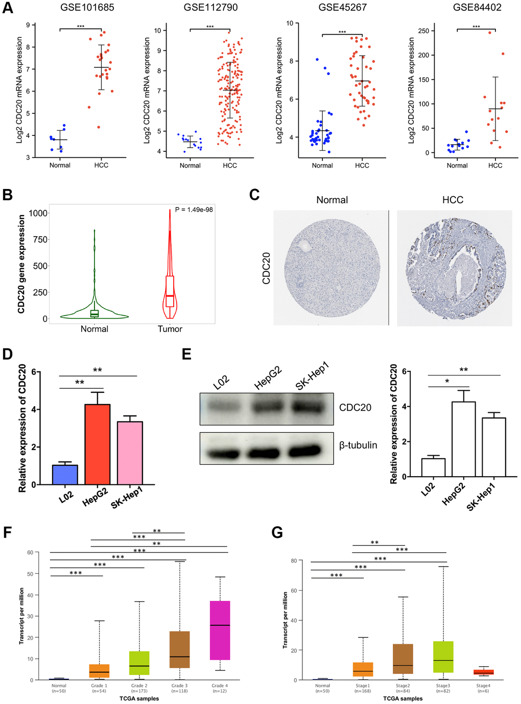 Associations between CDC20 and clinicopathological parameters in HCC. (A) Compared to normal liver tissues, the mRNA expression of CDC20 was increased in hepatocellular carcinoma tissues from four public HCC datasets. (B) TNM plot also showed the increased mRNA expression of CDC20 in hepatocellular carcinoma tissues. (C) Compared with the random normal liver tissues, the protein expression of CDC20 was increased in HCC tissues (the Human Protein Atlas, THPA). (D and E) qPCR and western blot showed that compared with the normal hepatocyte cell line L02, CDC20 expression was increased in hepatocellular carcinoma cell lines HepG2 and SK-Hep1. (F and G) The correlation of CDC20 with the tumor grades and cancer stages in patients with HCC.