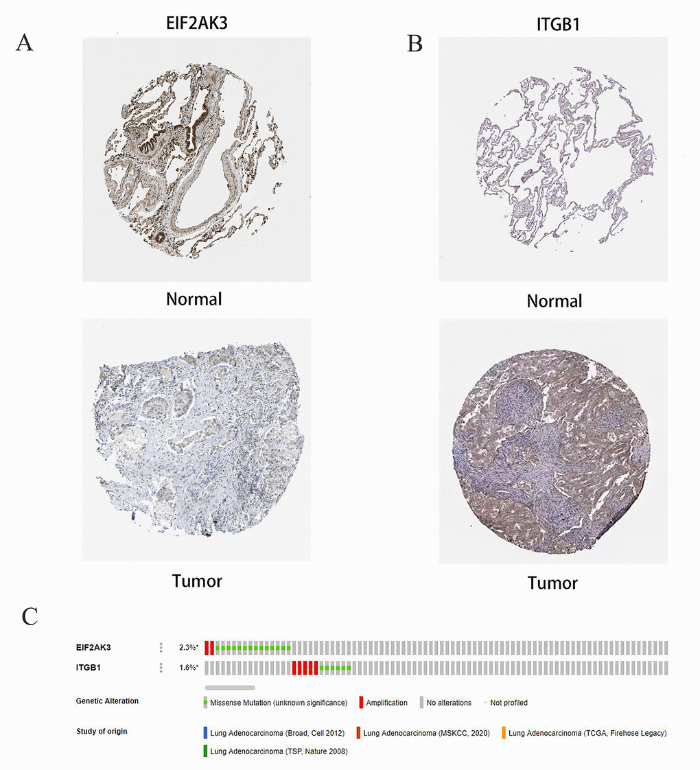 Immunohistochemical (IHC) results and the copy number and mRNA expression levels of two ARGs in the autophagy prognostic model. (A, B) The protein expressions of EIF2AK3 and ITGB1 were detected by the immunohistochemical method through the HPA database, and the staining intensity was labeled as low, moderate, and high. (C) OncoPrint showed the change of copy number and mRNA expression of two ARGs in the autophagy prognostic model.