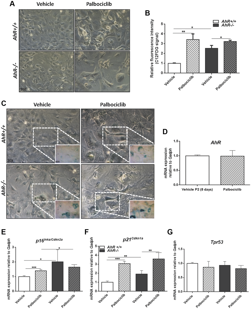 CDK4/6 inhibitor Palbociclib induces senescence in MEF cells and mimicks AhR deficiency. Embryonic fibroblasts were cultured for 48 h, then plated at 4 x 105 cells per 10-cm plate. Two days later, cells were treated with 4 μM CDK4/6 inhibitor Palbociclib/PD-0332991 for 8 days. (A) Bright-field microscopy of AhR+/+ and AhR−/− MEFs untreated or treated with Palbociclib. (B) Cell senescence measured as SA-β-Gal activity in AhR+/+ and AhR−/− MEFs. SA-β-Gal activity was analyzed by FACS using the β-galactosidase fluorescent substrate C12FDG. Results are normalized to vehicle-treated wild-type MEFs. (C) X-gal staining in untreated and Palbociclib treated AhR+/+ and AhR−/− MEFs. (D) AhR mRNA level was determined by RT-qPCR in AhR+/+ MEFs under both experimental conditions using oligonucleotides indicated in Supplementary Table 1. Determinations were done after 8 days of treatment with Palbociclib or vehicle (control). (E–G) mRNA levels of senescence driver genes p16Ink4a (E), p21Cip1 (F) and Trp53 (G) was determined in AhR+/+ and AhR−/− MEFs by RT-qPCR using oligonucleotides indicated in Supplementary Table 1. Gapdh was used to normalize target gene expression (△Ct) and 2−△△Ct to calculate changes in mRNA levels with respect to wild type or untreated conditions. Data are shown as mean + SD (*P **P ***P 