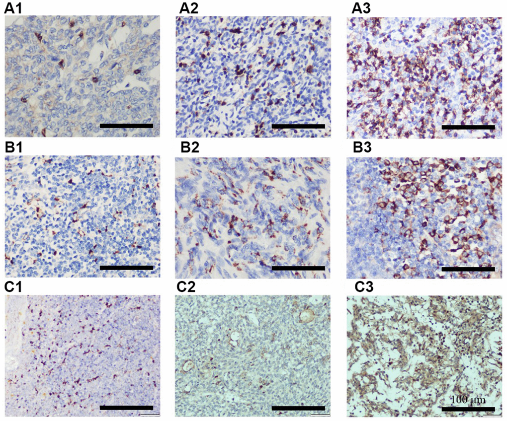 Representative IHC images showing different expression of CD8 (A1–A3), CD68 (B1–B3), and CCL18 (C1–C3). A1, B1, and C1 indicates + IHC score; A2, B2, and C2 indicates ++ IHC score; A3, B3, and C3 indicates +++ IHC score. (n = 3 for A–C groups; scale bars, 200 μm).