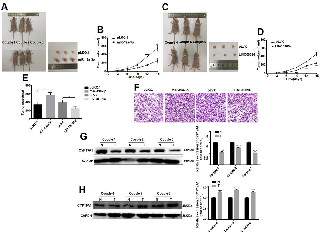 Tumorigenesis experiments in nude mice in vivo proved the effects of LINC00094 and miR-19a-3p on breast cancer. (A) 5×106 BT-474 cells with stable expression of miR-19a-3p were injected into the breast fat pad of 4-week-old female BALB/c nude mice, and tumors were collected on the 15th day of tumor formation. (B) The tumor size of nude mice was measured every 3 days. (C) 5×106 BT-474 cells statically expressed by LINC00094 were injected into the breast fat pad of 4-week-old female BALB/c nude mice, and tumors were collected on the 15th day of tumor formation. (D) Tumor size of nude mice was measured every 3 days. 3-5 nude mice of LINC00094 stable expression group and control group were respectively. There was statistical difference between experimental group and control group. ***PE) On the 15th day, the tumor of nude mice in each group was taken and weighed. There were statistical differences between the experimental group and the control group. *PPF) Tumor tissues of nude mice were stained with HE. (G) Western Blot was used to detect CYP19A1 protein expression level of the first pair to the third pair, with GAPDH as internal reference, and the experiment was repeated for 3 times. N is the control group. T is the experimental group. ***PPH) Western Blot was used to detect CYP19A1 protein expression level of the 4th to 6th pairs, with GAPDH as internal reference, and the experiment was repeated for 3 times. N is the control group. T is the experimental group. ***PP