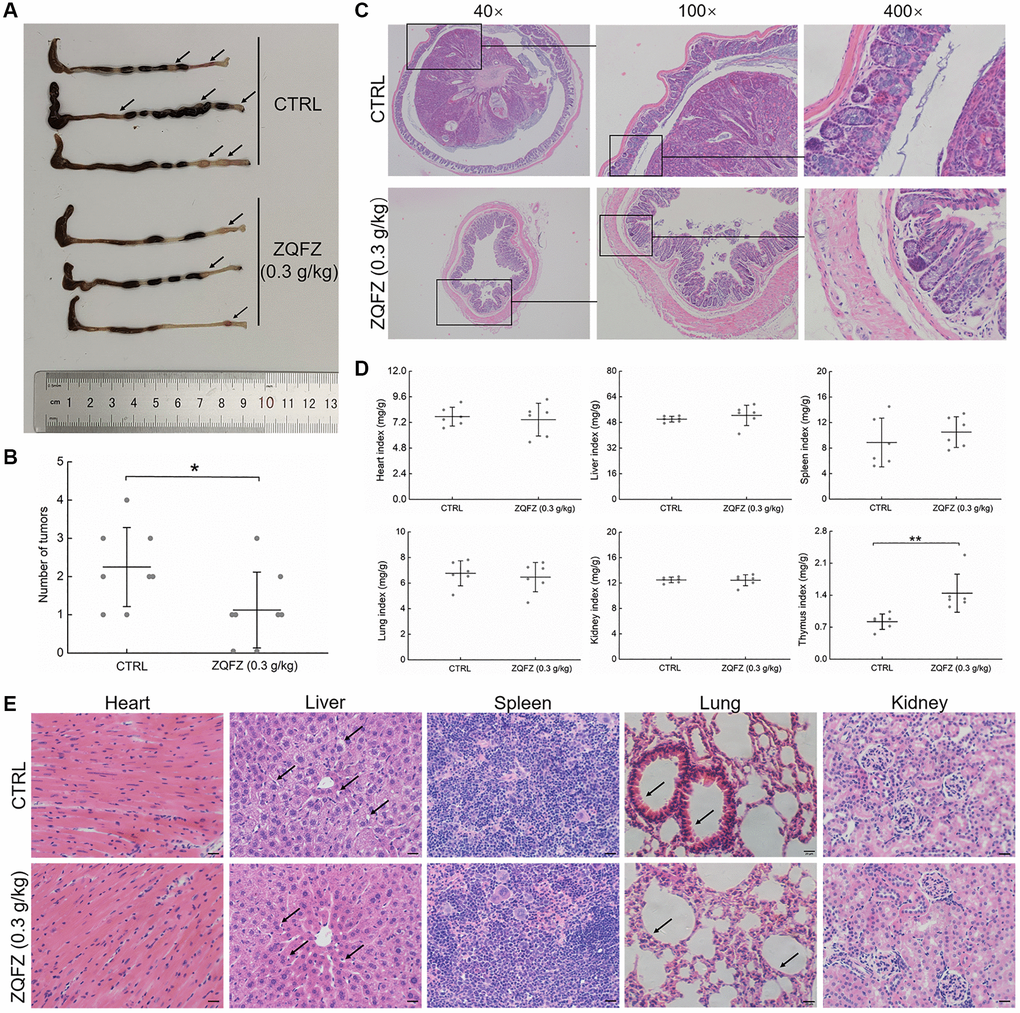 The improving effect of ZQFZ on colorectum and viscus in ApcMin/+ mice. (A) The effect of ZQFZ on the colorectal morphology, black arrows indicated colorectal tumors. (B) The effects of ZQFZ on the number of colorectal tumors (n = 8 mice/group). H&E staining was used to evaluate pathological alterations of (C) colorectum (400×, scale bar: 20 μm), (D) The effects of ZQFZ on organ indexes (n = 6 mice/group), (E) heart, liver, spleen, lung and kidney (400×, scale bar: 20 μm) under a light-microscope digital camera (n = 3 mice/group), black arrows indicated with vacuolar degeneration in the liver and inflammatory cell infiltration in pulmonary alveoli. Data was shown as the mean ± SD and determined via a one-way ANOVA test. **p 