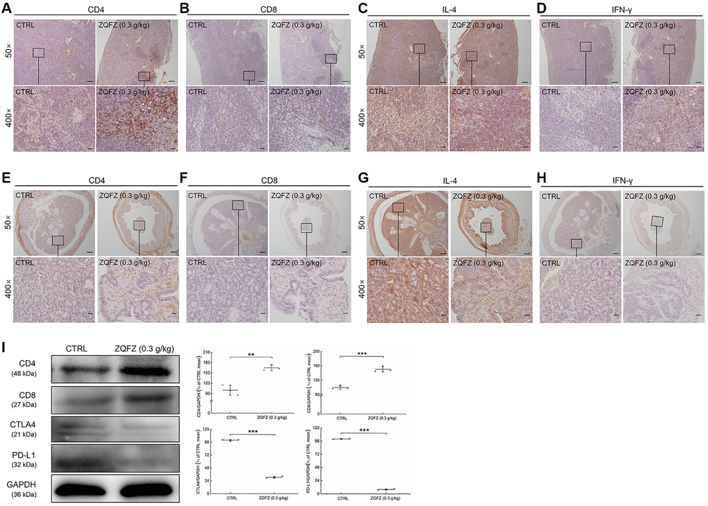 ZQFZ regulated immune-related proteins of spleen and colorectum in ApcMin/+ mice. Base on the result of immunohistochemical staining, ZQFZ enhanced (A) CD4 and (B) CD8, no affect (C) IL-4, and enhanced (D) IFN-γ in spleen, and enhanced (E) CD4 and (F) CD8, no affect (G) IL-4, and enhanced (H) IFN-γ in colorectal tumors (50×, scale bar: 200 μm; 400×, scale bar: 20 μm). The protein expression levels of (I) CD4, CD8, CTLA4 and PD-L1 in colorectal tumor were detected by western blotting. The quantitative data of the protein expression levels were normalized by GAPDH expressions and were shown as a percentage of the corresponding relative intensity of the CTRL group. Data are shown as the mean ± SD and analyzed via a one-way ANOVA test. (n = 3). **p ***p 
