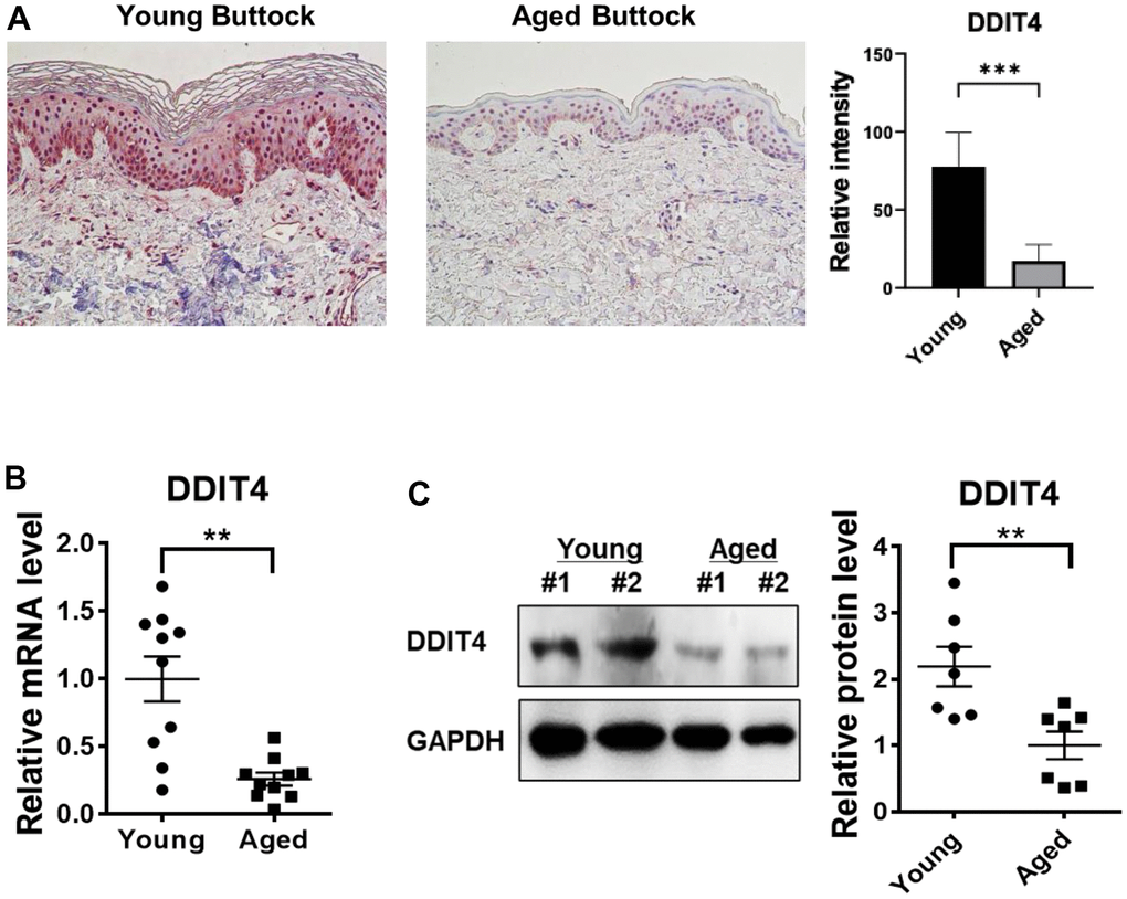 DDIT4 expression level was decreased in aged human skin in vivo. (A) Buttock skin samples of young and elderly subjects were obtained by punch biopsy. DDIT4 expression in the skin of individuals was examined by immunohistochemistry and quantified. Immunohistochemistry analysis was performed using paraffin-embedded sections. Original magnification: x200. Data represent the mean ± SE (n=6, *** P B, C) Quantification of relative mRNA (n = 10) and protein (n = 7) levels of DDIT4 was performed using qPCR and western blotting. GAPDH served as a loading control. Data represent the mean ± SE (** P 