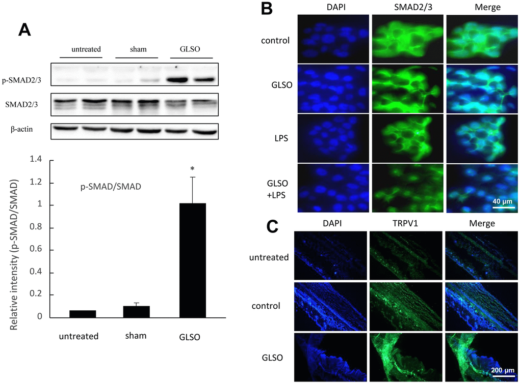 Analysis of SMAD2/3 and TRPV1 expression in mouse skin burn. (A) Western blot (upper) and quantitative analyses (lower) of SMAD2/3 and p-SMAD2/3. (B) Immunofluorescence staining of SMAD2/3 nuclear translocation on LPS (1 μg/mL) induction. Scale bar=200 μm. (C) Immunofluorescence staining of TRPV1 expression in skin burn upon GLSO treatment. Scale bar=200 μm. The data are presented as the mean ± SD. *P