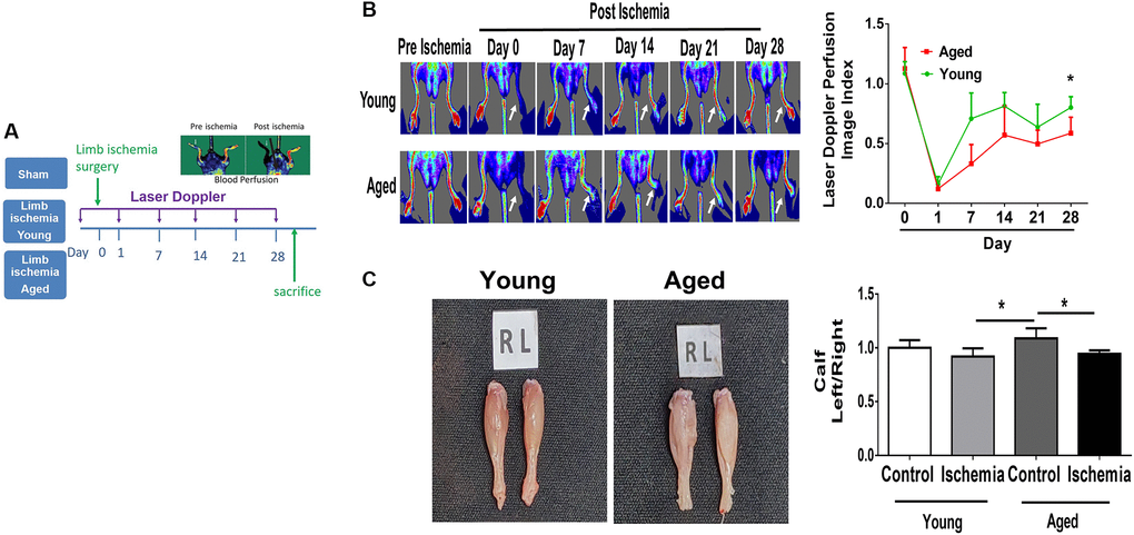 Impaired angiogenesis of aged mice post hindlimb ischemia surgery. (A) The study design of limb ischemia in young (10 w/o) and aged (80–100 w/o) mice. (B) Representative images of laser Doppler perfusion flow in limb ischemia in young and aged mice. (C) Representative images and weight quantifications of harvested ischemic (left) limbs compared with nonischemic (right) limbs. N = 6, *P 