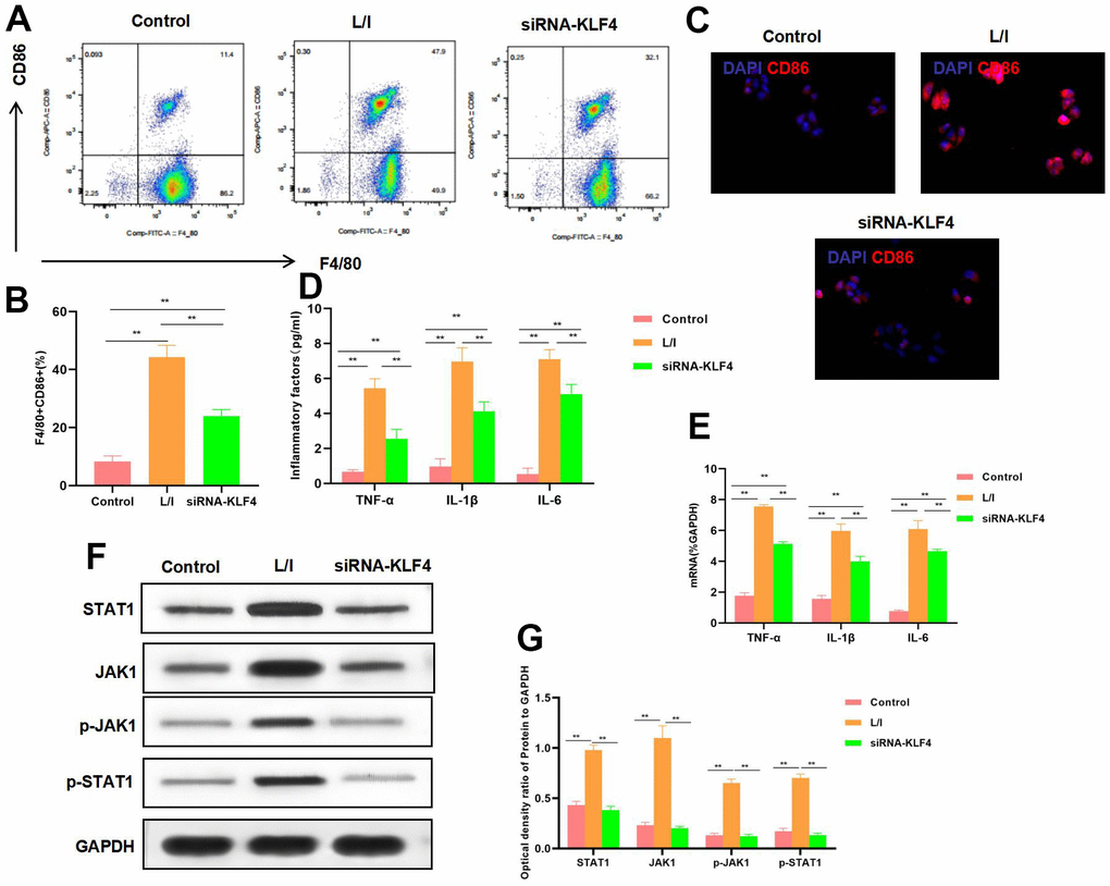 Effect of KLF4 silencing on M1 polarization of macrophages. (A, B) The proportion of M1 cells was detected by flow cytometry (n=3): KLF4 silencing (siRNA-KLF4) decreased the F4/80+CD86+ cell proportion, The proportion of cells in siRNA-KLF4 was lower than that in L/I. **PC) IF staining of CD86. KLF4 silencing suppressed CD86 expression, and decreased the fluorescence intensity. (D) Expression of M1 cell marker proteins (n=3, TNF-α, IL-6, IL-1β). KLF4 silencing (siRNA-KLF4) suppressed the expression of inflammatory factors TNF-α, IL-6 and IL-1β. Compared with L/I, the expression of cytokines decreased significantly**PE) Expression of mRNA (n=3, TNF-α, IL-6, IL-1β). KLF4 silencing (siRNA-KLF4) suppressed the expression of mRNA. Compared with L/I, the expression of cytokines decreased significantly**PF, G) Expression of JAK1-STAT1 signal proteins (n=3). KLF4 silencing suppressed the expression of JAK1 and STAT1 proteins, decreased the phosphorylation levels. **P