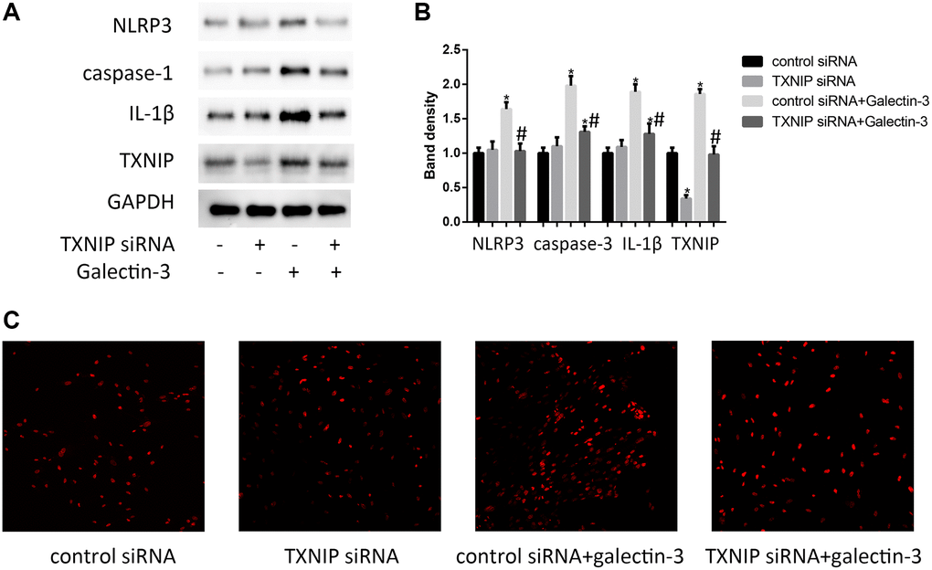 TXNIP mediated galectin-3-induced ROS and inflammation factors expression in VSMCs. VSMCs were treated with 10 μg/ml galectin-3 and (or) TXNIP siRNA for 24 h, The protein expression level of NLRP3, caspase-1, and IL-1β were measured by western blot, the results quantifications were shown in the right panel (A and B). Band density of native VSMCs was defined as a control and considered to 1. DHE staining was used to observe the ROS production (C). Data were obtained from three independent experiments. *P #P 