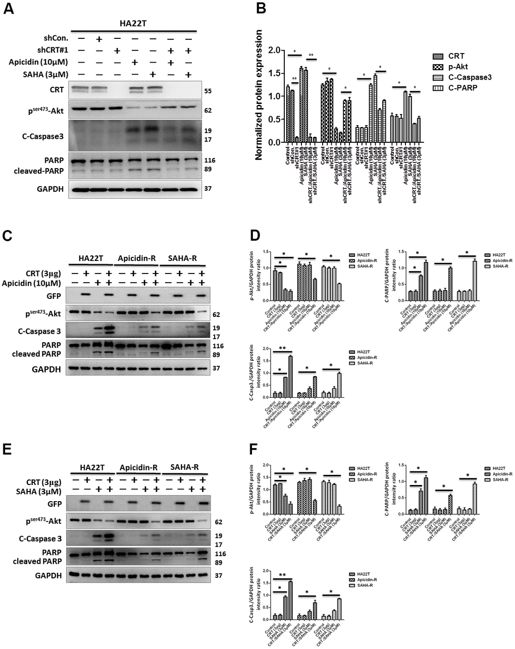 Effect of overexpression and downregulation of CRT overexpression on cell apoptosis in HCC cells treated with HDAC inhibitors. (A, B) shRNA-mediated knockdown of CRT enhances drug-resistance in HDAC inhibitor-treated cells than in HA22T parental cells. (C–F) Overexpression of CRT overexpression enhances HDAC inhibitor-induced chemosensitivity in HDAC inhibitor-resistant cells than in parental cells. All protein samples are analyzed using western blotting. Protein expression is normalized to expression of GAPDH. *p p p