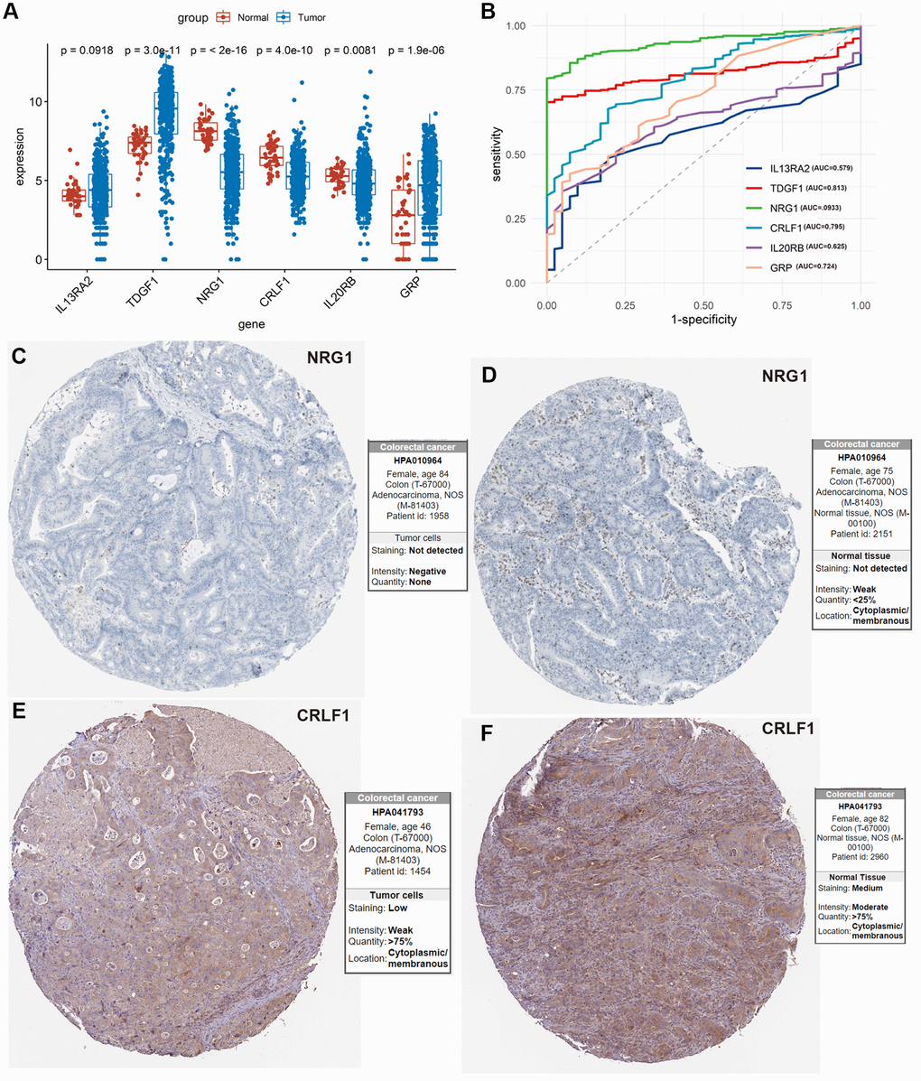 Exploration of the 6 IRIGs as predictive diagnostic indicators based on the TCGA-COAD cohort. (A) Comparison of the expressions of the IRIGs between tumor and normal samples using the Wilcoxon test. (B) Establishment of the predictive diagnosis model using the 6 IRIGs. (C–F) The comparison of protein expression of NRG1 and CRLF1 between tumor and normal tissues.