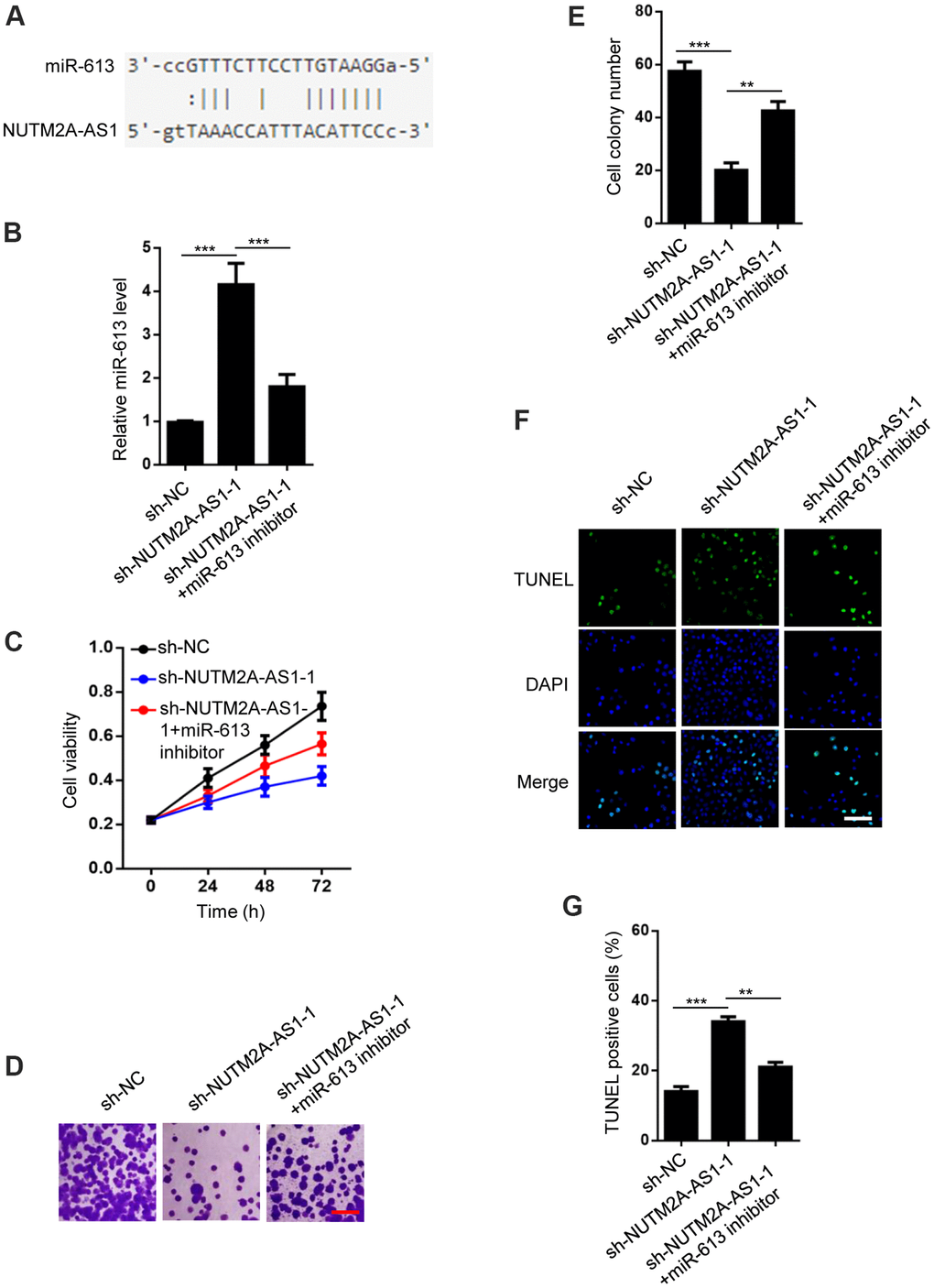 MiR-613 rescues NUTM2A-AS1-regulated matrine resistance in GC cells. (A) StarBase 2.0 shows that miR-613 is a target of NUTM2A-AS1. (B) The reverse transcription-quantitative polymerase chain reaction was employed to evaluate the levels of miR-613 in N87 cells transfected with sh-NC, sh-NUTM2A-AS1-1, or sh-NUTM2A-AS1-1 plus the miR-613 inhibitor. ***P C) The viability of N87 cells transfected with sh-NC, sh-NUTM2A-AS1-1, or sh-NUTM2A-AS1-1 plus the miR-613 inhibitor under matrine treatment was examined by using the MTT assay. *P **P D, E) Cell colonies of N87 cells transfected with sh-NC, sh-NUTM2A-AS1-1, or sh-NUTM2A-AS1-1 plus the miR-613 inhibitor under matrine treatment. Scale bar, 5 μm. **P ***P F, G) Apoptosis of N87 cells transfected with sh-NC, sh-NUTM2A-AS1-1, or sh-NUTM2A-AS1-1 plus the miR-613 inhibitor under matrine treatment was examined by using the TUNEL assay. Scale bar, 5 μm. **P ***P 