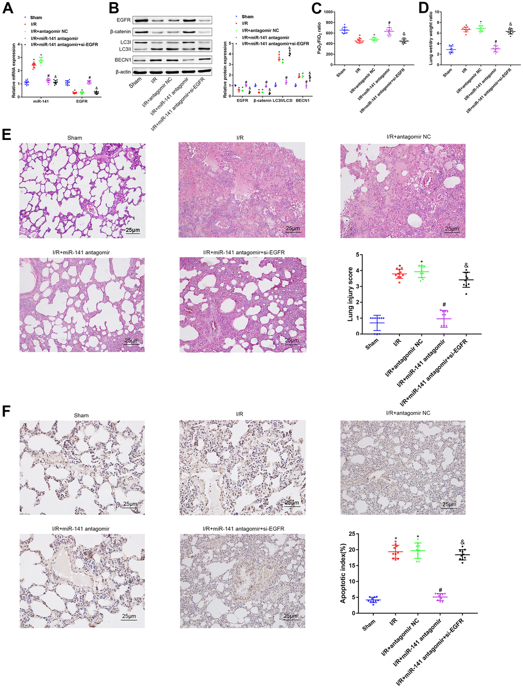 miR-141 inhibits EGFR to downregulate β-catenin, thereby enhancing autophagy to promote lung I/R injury in vivo. (A) RT-qPCR was used to detect the expression of miR-141 and EGFR in mouse lung tissues. (B) Western blotting was used to detect the protein expression of ERFG, β-catenin, LC3II/I and BECN1 in mouse lung tissues. (C) Blood gas analyzer was used to detect the blood gas in arterial blood in left ventricle of mice. (D) The statistical graph of W/D ratio of lung tissues of mice. (E) HE staining results of lung tissues (× 400) and lung injury scores. (F) TUNEL staining (× 200) was used to detect the apoptosis of mouse lung cells. * p 