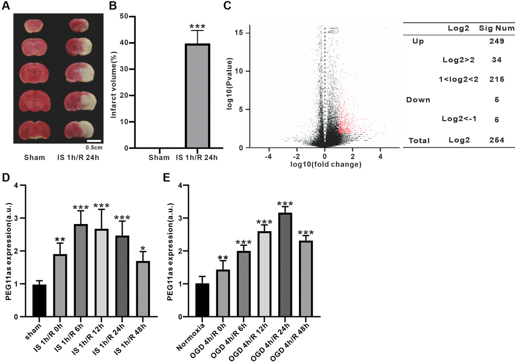 PEG11as expression in tMCAO/R mice and cellular OGD/R models. (A, B) TTC staining evaluation and statistical analysis of mouse cerebral infarct volume induced by MCAO 1 h/R 24 h (n = 6). (C) Volcano plot of lncRNA expression differences in ischemic penumbra. Red spots represent differentially expressed genes. (D, E) PEG11as level determined by RT-PCR in the ischemic penumbra of cerebral IS/R mice (n = 6) and OGD/R-treated N2a cells (n = 6). One-way ANOVA followed by the Tukey’s post-hoc-test was used, data are shown as mean ± SD. *P **P ***P 