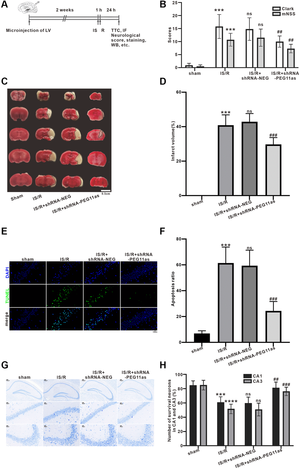 PEG11as silencing alleviates the acute injury of cerebral neurons induced by cerebral IS/R. (A) Illustration of the experimental procedure. (B) The average neurological scores of Clark and mNSS tests (n = 10). (C, D) Representative pictures and statistical chart for TTC staining. (E, F) Representative images and statistics of TUNEL staining of brain sections for assaying neuronal apoptosis. (G, H) Representative pictures and statistical chart of Nissl staining in the CA1 and CA3. n = 6. One-way ANOVA followed by the Tukey’s post-hoc-test was used, data are shown as mean ± SD. ***P #P ##P 